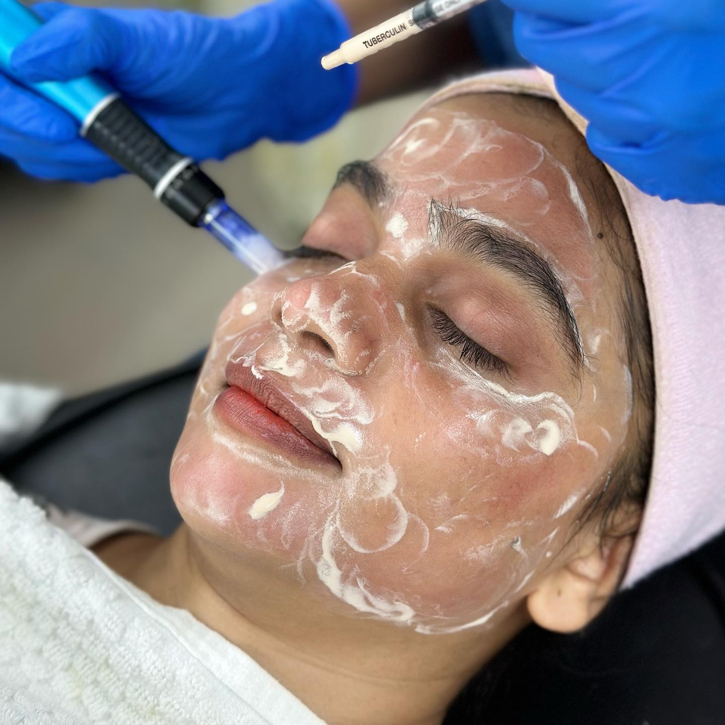 Pro BB Glow
Book your Appointment
#hydrafacial #bbglow #facial #facialtreatment #dombivli