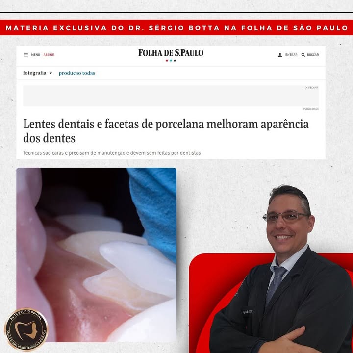 ✨ Nossa expertise em harmonização do sorriso foi destaque na Folha de São Paulo!
📰As lentes de contato dentais e as facetas de porcelana são soluções que transformam sorrisos, oferecendo resultados naturais e estéticos quando feitas com a técnica e precisão necessárias.
Confira a matéria completa e entenda mais sobre como essas técnicas podem elevar a sua autoestima e confiança.
Link: https://www1.folha.uol.com.br/equilibrio/2024/09/lentes-de-contato-melhoram-aparencia-dos-dentes-mas-devem-ter-indicacao-e-manutencao-corretas.shtml