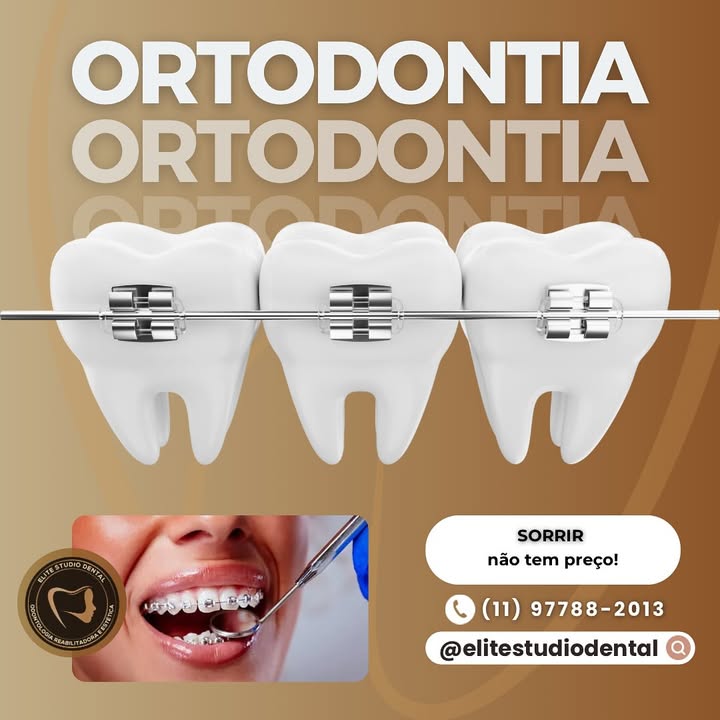 Seu sorriso pode ser transformado com a ortodontia! 😁
🦷 Alinhe seus dentes e eleve sua autoestima com um tratamento que traz saúde e estética. Agende sua avaliação no Elite Studio Dental e descubra como podemos ajudar você a conquistar o sorriso que sempre sonhou! 💫
📞 (11) 97788-2013 📲 @elitestudiodental
Sorrir não tem preço, e estamos aqui para te ajudar nesse processo!