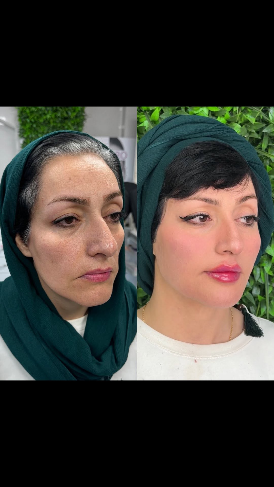 تز(یق فیلر برای مراجعه کننده عزیزمون که دوست داشتن حجم های از دست رفته صورتشون جبران بشه و همزمان جوانسازی عالی هم واسشون انجام شد🥰🥰
فکر میکنید چند سال جوانتر شدن؟؟
اگر دوست دارین بدونید چه کارهایی واسشون انجام شده کلمه (فول فیس) رو کامن//ت کنید😊
#فول_فیس #کانتورینگ_صورت #جوانسازی_صورت #اصلاح_کادر_چشم_ابرو #شیراز #مادلینگ_صورت