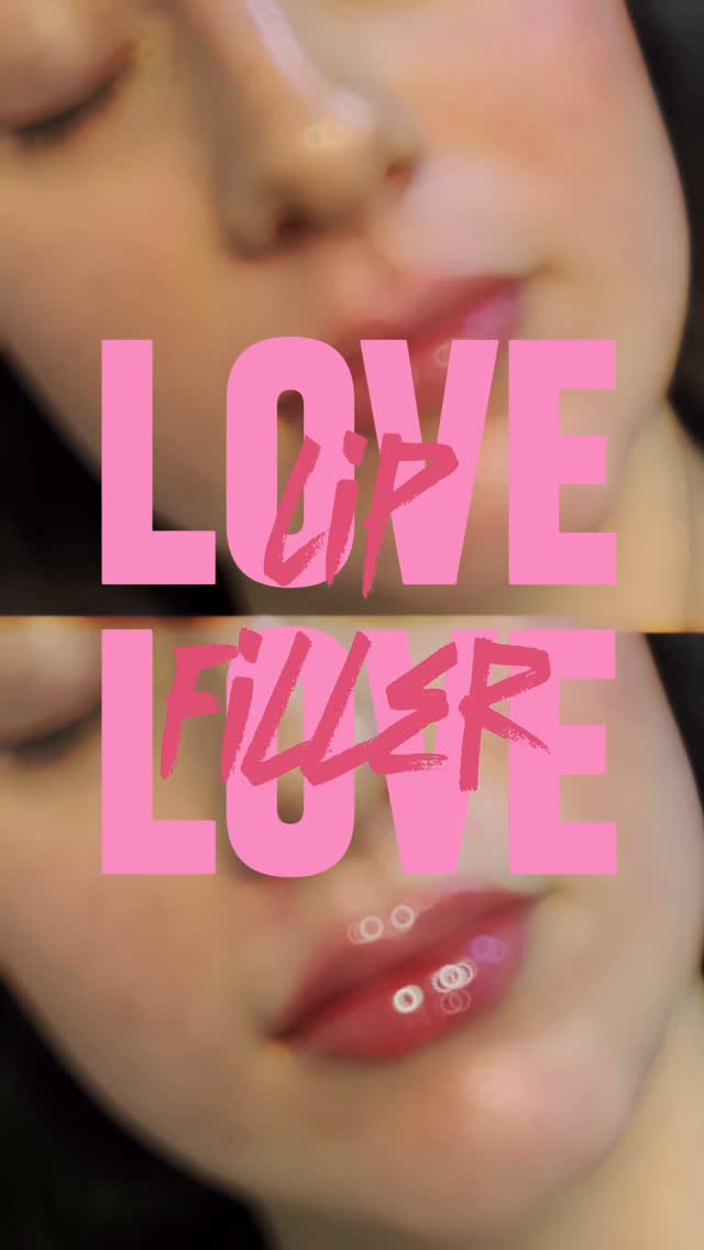 💋✨ Only 2 days left to claim your FREE Miria laser treatment! ✨💋
Nurse Jenna is delivering stunning, natural-looking lips, just in time for Valentine’s Day! Whether you want a subtle hydration boost or a perfectly plumped pout, now’s the time to book. 💉💖
💘 Valentine’s Day Special: Get lip filler by February 14th and receive a FREE superficial Miria laser treatment—because your glow-up deserves the full package! ✨ The Miria laser helps brighten, refresh, and rejuvenate your skin, leaving you radiant for any occasion.
🔥 You only have 2 days left to take advantage of this deal! Your free laser treatment must be redeemed by March 15th, so don’t miss out!
📞 Call us now to book before time runs out! ⏳💘
#austinplasticsurgeon #aps #Austin #atx #austintx #satx #lipfiller #lipaugmentation #valentinespecial #beautydeals #austinmedspa #mirialaser #skincareglow #austininjector #selfcare #lipenhancement