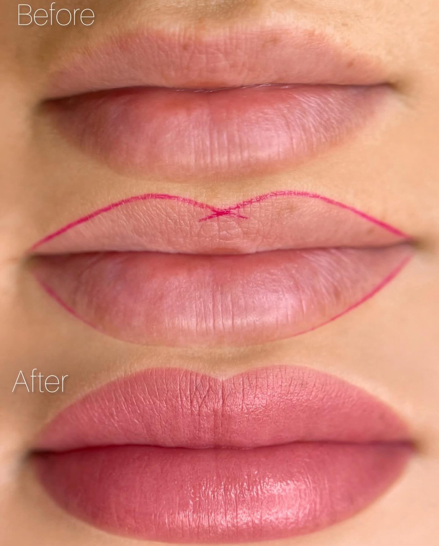 Book your lipblush now ♥️ #semipermenantmakeup#beautybloggers#beautyaddict#londoncity#facials#hydrafacialresults#lithopsfaceandbody#whetstone#totteridgeandwhetstone#scalptattoo#lithopsbeauty#scalpmictopigmentation#micropigmentation#londonlife#beautysalon#beautytips#beautymakeup#scalp#bbglowtreatment#collagen#lithopslondon#hydrafacialresults#bbglowlondon#facialtreatment#facials#beautytips#beautybloggers#semipermenanteyeliner#lithopsbeauty#bbglowlondon#beautytips#beautysalon#facialtreatment