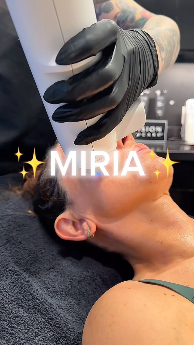 ✨ Rejuvenate and Revitalize with Miria ✨
Tired of wrinkles, acne, or skin laxity? The Miria Laser is here to help! Combining different laser treatments, this powerful, non-invasive technology targets multiple skin concerns, from surgical scars to poor texture – on BOTH face AND body! 🙌
🔬 With Focal Point Technology™ and Fractional Laser Technology, Miria provides precision treatment that delivers incredible results with minimal downtime. Plus, ComfortCool™ keeps you cool and comfortable throughout, making recovery a breeze! 💨
Best part? It’s safe for ALL skin tones & now available at ALL 3 of our locations! 📍
Get ready to experience the best version of your skin! 🫧
#austinplasticsurgeon #aps #skincare #innovativeskincare #glowingskin #Miria #lasertreatment #noninvasiveprocedure #healthyglow #comfortabletreatment #skingoals #atx #satx
