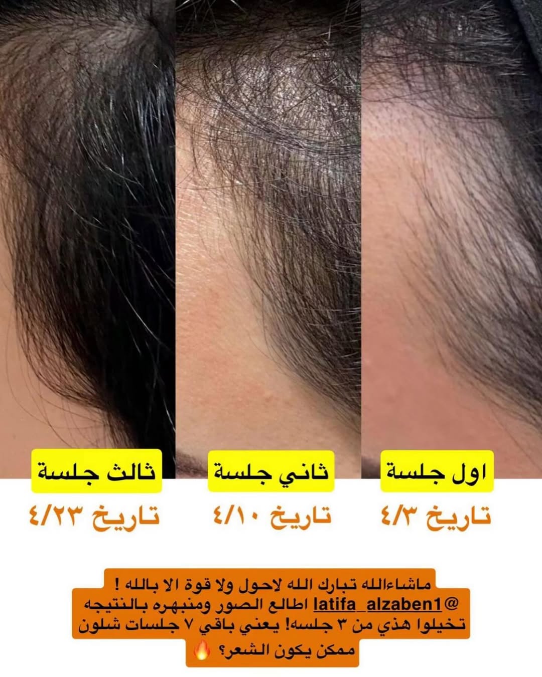 تجربة كورس التنبيت مع لطيفة الزبن
نتايج الكورس فورية ويبين معاكم الفرق من أول جلسة