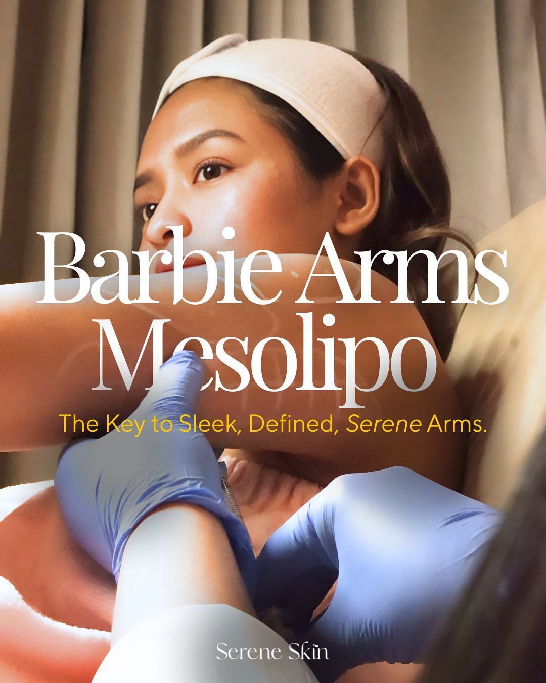 Struggling with stubborn arm fat or looking to soften overly defined muscles? 💪🏻🤔The Barbie Arms and Mesolipo combo targets both—fat reduction + subtle muscle contouring for a more sculpted, feminine silhouette 💃🏻.
Book your appointment today!
💌 +63 995 482 5232
#SereneSkinPh #SereneSkin #DermaCare #SereneArms #BarbieArms #Mesolipo #LipolyticMedicine #BotulinumInjection #SkinCare #DermaQuezonCity #DermatologyClinic #Manila #QuezonCity