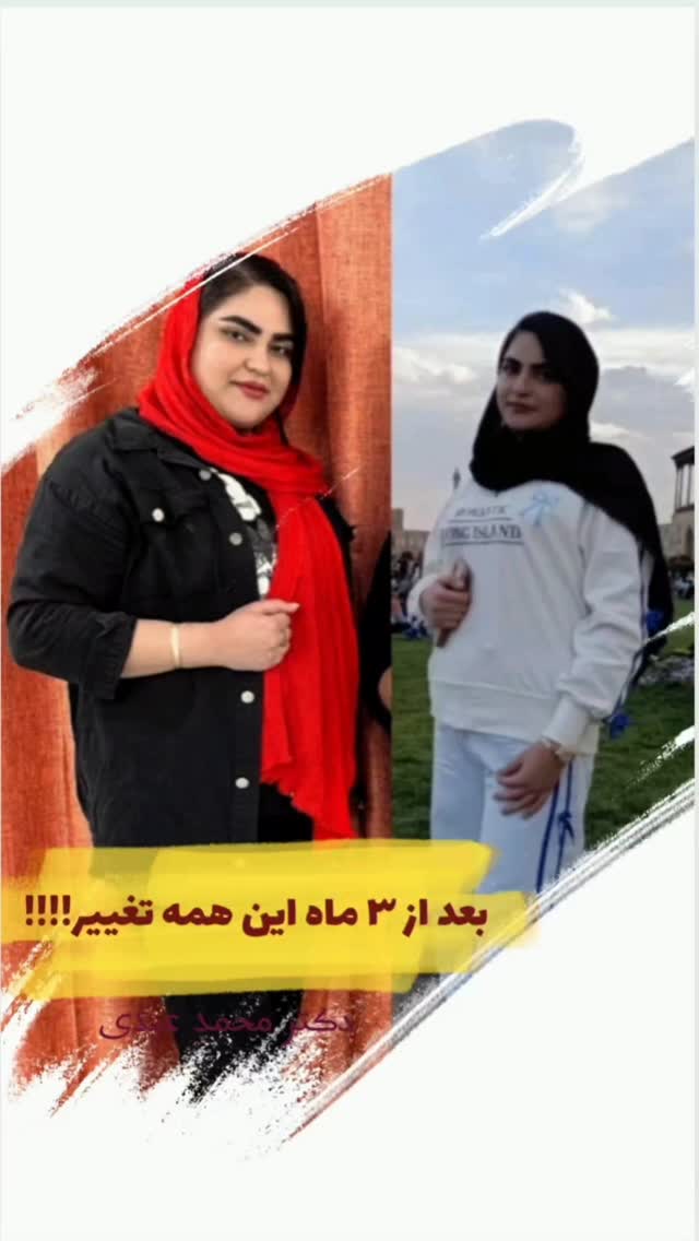 کاهش ۳۰ کیلوگرمی بیمار عزیزم بعد از ۳ ماه😍
👨🏻⚕دکتر محمد عیدی متخصص جراحی عمومی و عروق فوق تخصص جراحیهای اندوسکوپی و چاقی
📍کاشان، خیابان بهشتی، بالای داروخانه قریشی، ساختمان اردیبهشت طبقه ۳
☎️ 031-55584207
🆔 @dr.mohammad.eidy
🔷🔹🔷
🌐 http://dreidy.ir/
