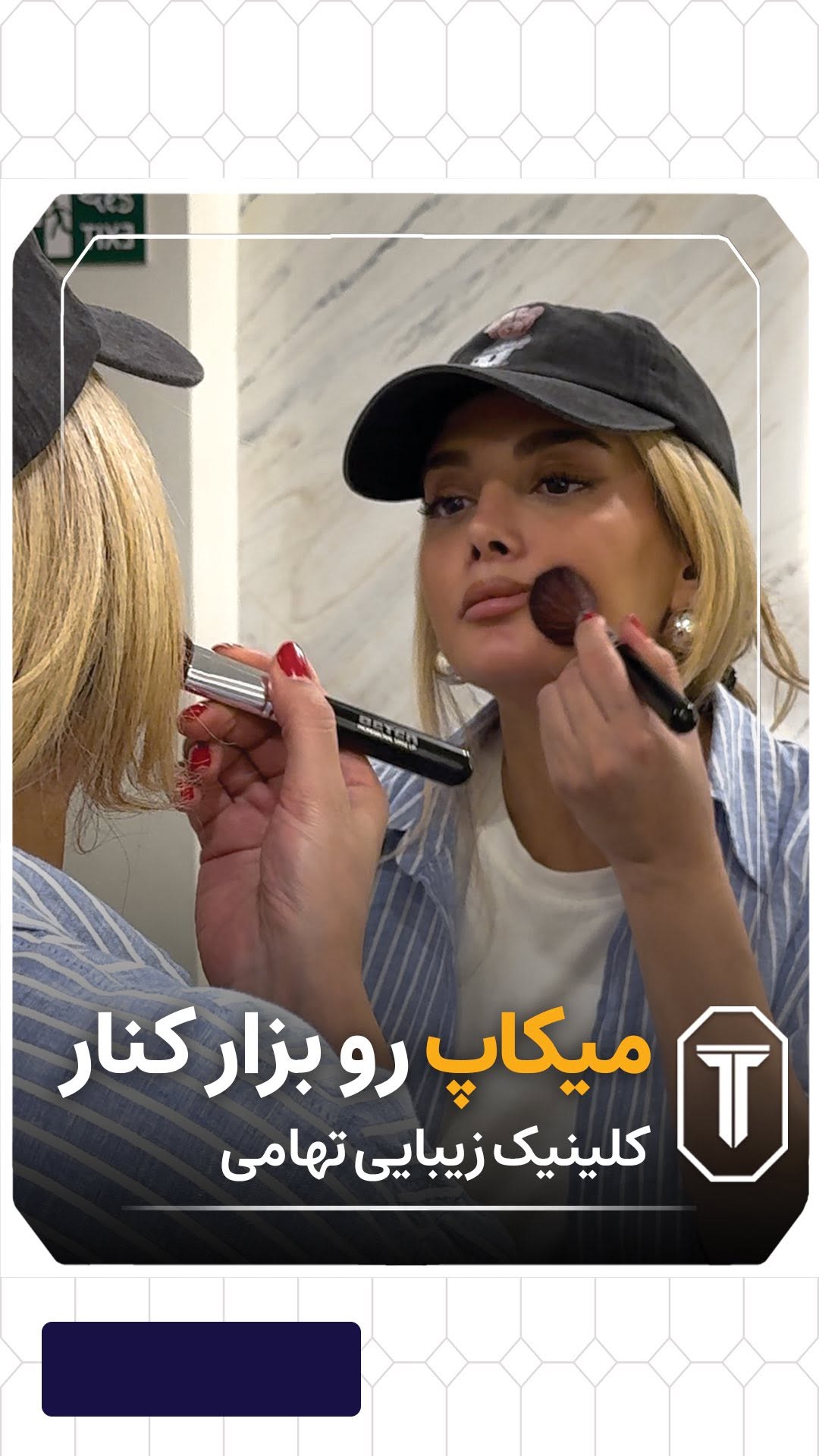 | دقیقه آخر انتخابش عوض شد 🧐
جالپرو سوپر هیدرو آبرسانی قوی و لیفتینگ بالایی داره
حاوی هیالورونیک اسید با غلظت بالا برای هیدراته کردن و حجمدهی پوست استفاده میشه ✅
با توجه به توضیحات خانم دکتر
کدوم مدل جالوپرو برای پوست شما مناسب تره؟؟
جهت مشاوره باما تماس بگیرید
شماره تماس در بایو پیج ☎️
#جالوپرو #ابرسانی_پوست #کلینیک_تهامی #هیدرو #لیفتینگ_پوست #پروفایلو #تزریق_پروفایلو #تزریق_جالپرو #جوانسازی_پوست #آبرسانی_پوست #هیالورونیک_اسید #زیبایی_طبیعی #کلینیک_تهامی