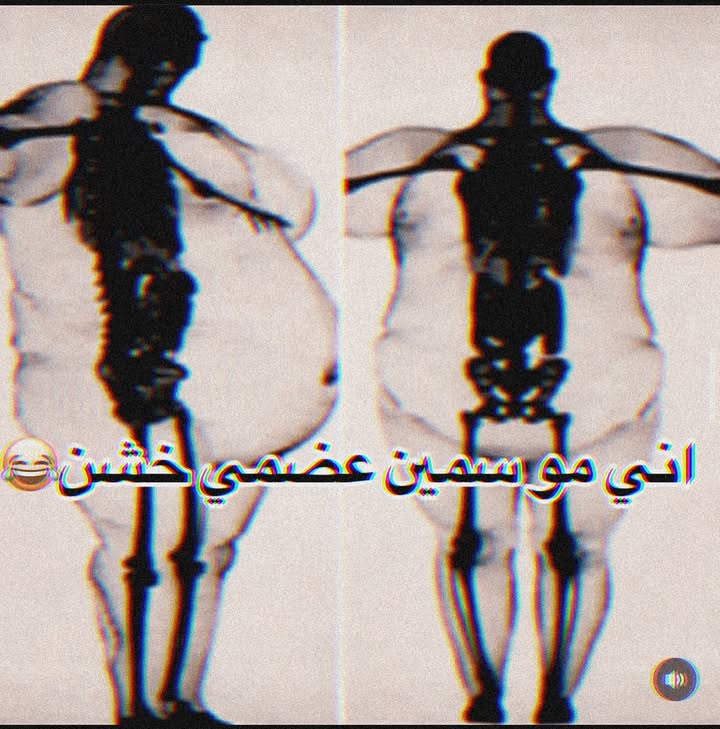 ابد مو سمين الحـقيـࢪ 😂💔
#السعودية #اینستاگرام #تحشيش #ضحك #نكات #حب #غزل #تفاعلو #لايكات #تعليق