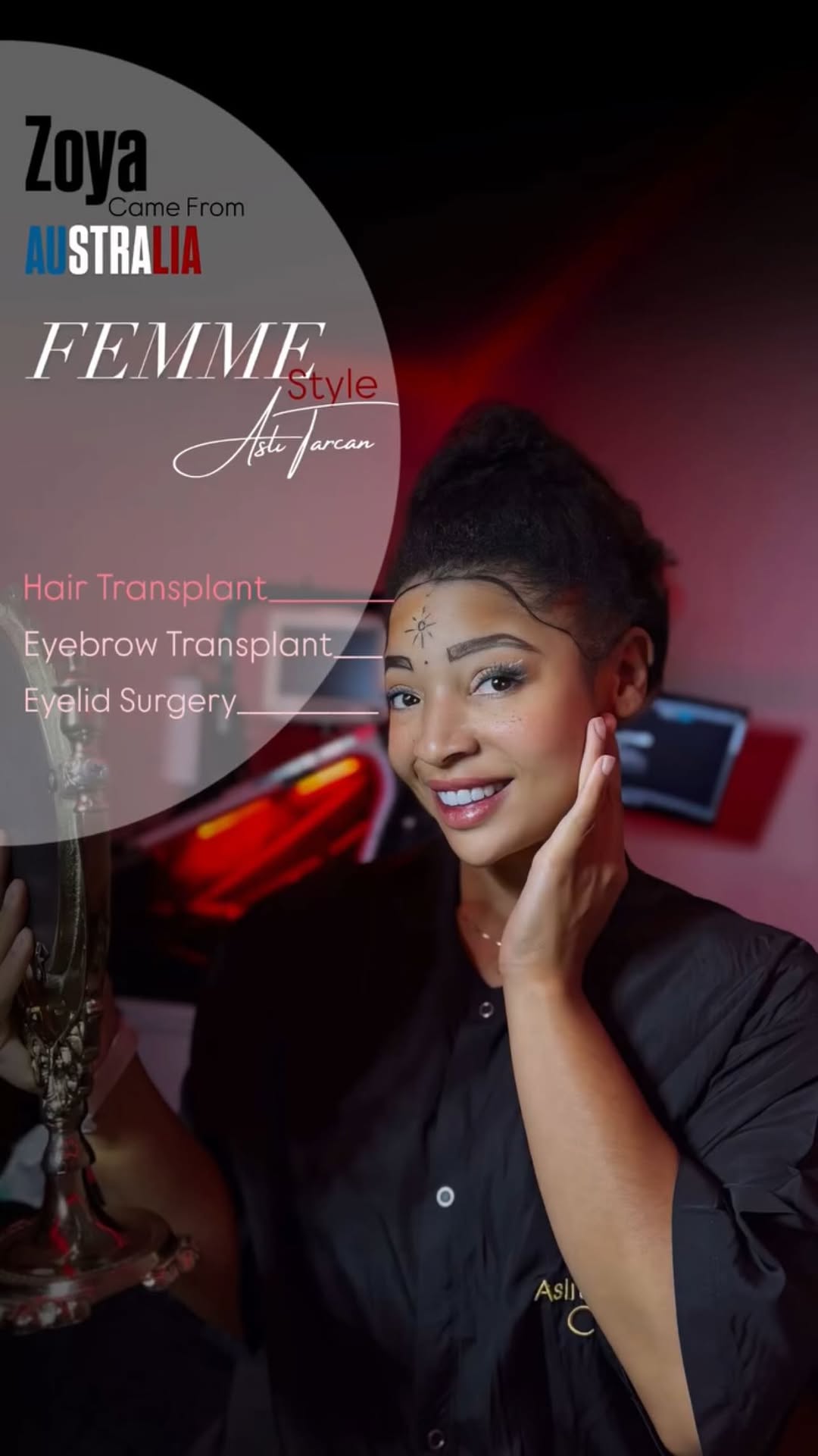 She came to us not just to restore her hair — but to restore the woman behind the mirror.
After years of hair thinning and trying every so-called solution, she was ready for a real transformation. At Aslı Tarcan Clinic, we welcomed her with understanding, precision, and innovation.
Her personalized plan began with Robotic DHI Hair Transplantation — the most advanced technique today:
✔️ No shaving
✔️ No pain
✔️ No visible scars
Every follicle was placed with robotic precision, following her natural hair direction, ensuring a dense and seamless look.
We didn’t stop there.
Her eyebrows, once thinned and faded, were carefully restored to frame her face with strength and softness.
With expert hands and heartfelt care, she began a journey not just of aesthetic change — but of emotional rebirth.
Because at Aslı Tarcan, we don’t just restore hair.
We restore confidence, identity, and inner strength. #HairRebirth #4800Grafts #DHIHairTransplant #BoldTransformation #AsliTarcanClinic #HairGoals #OwnYourCrown #ConfidenceInEveryStrand #BeautyIsPower #RealStories #HairJourney #BlackBeautyMagic #afrohairtransplant #hairtransplant #roboticdhihairtransplant #roboticdhı