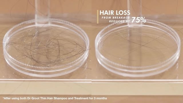 Dr Groot Hair Loss Thin Hair Shampoo😍
Dr.Groot Soch to’kilishiga qarshi shampun ingichka sochlar uchun 400ml - lingji ekstrakti bilan zaif, ingichka sochlarni ildizidan mustahkamlaydi va mustahkamligini yaxshilaydi va sochlarga chidamlilik beradi.🔥
@lg_cosmetics__uz