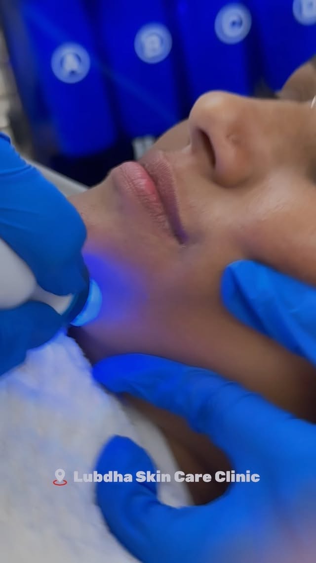 Lubdha Skin Care Everyone can benefit from a deep clean! HydraFacial offers a deep rejuvenation of the skins protective barrier, with multiple steps to exfoliate and extract bacteria and build up! Book your monsoon facial in!
📱+91 9967813766
#hydrafacial #faical #lubdhaskincare #prptreatment #lipstreatment #dombivli #kalamanchtattoostudio #reelsinstagram #reelindia #reelitfeelit❤️❤️ #instafashion #modelshoot #follow #drmanisha