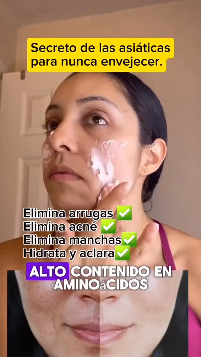#rejuvenecimientofacialsincirugia #rejuvenecimiento #rejuvenecimientofacial #bellezanatural