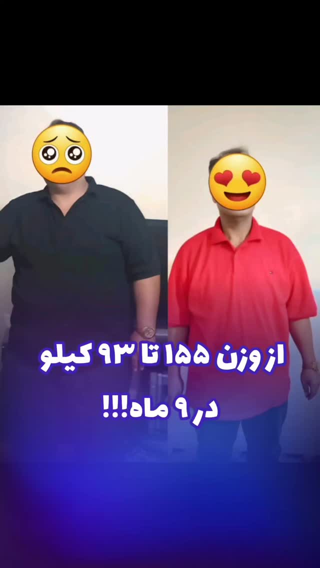 عکس ارسالی بیمار عزیزم و کاهش وزن ۶۲ کیلوگرمی در ۹ ماه
محمد عیدی متخصص جراحی عمومی و عروق فوق تخصص جراحیهای اندوسکوپی و چاقی
📍کاشان، خیابان بهشتی، بالای داروخانه قریشی، ساختمان اردیبهشت طبقه ۳
☎️ 031-55584207
🆔 @dr.mohammad.eidy
🔷🔹🔷
🌐 http://dreidy.ir/
#جراحی_بای_پس#جراحی_اسلیو#بای_پس_معده#اسلیو_معده