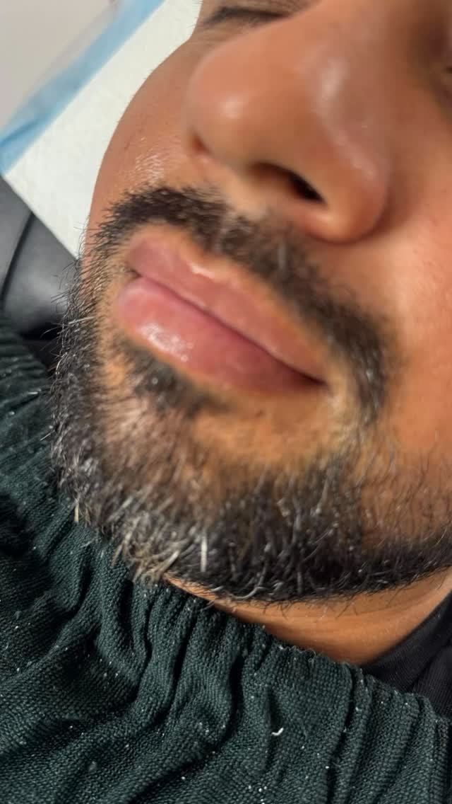 ✨ Hoy despedimos con orgullo a nuestras estudiantes del curso de Micropigmentación de Labios y Cejas DELUXE 4.0 ✨
¡Qué emoción verlas en su último día realizando su modelo real, aplicando con seguridad todo lo aprendido!
Gracias por su entrega, confianza y pasión. Verlas crecer como artistas y como mujeres nos llena el corazón. ❤️
A todas las que sueñan con comenzar en el mundo de la belleza:
¡Sí se puede! Cuando hay decisión y ganas, los sueños se cumplen. Hoy ellas lo lograron… mañana puedes ser tú.
🎓 Formación real
💋 Prácticas reales
🤝 Seguimiento y acompañamiento
🔥 Una comunidad que te impulsa a crecer
👉 ¿Quieres ser la próxima?
Dale like, coméntame “QUIERO INFO” y sígueme para más contenido real y motivador.
💬 Comparte esta publicación con esa amiga que necesita este impulso. 💕
Con cariño,
Lucy Frontal — Servicies Lucy Frontal
#perfectbrowsbylucy #cejasperfectas #cejasypestañas #aprendeconlucy #ombrebrowshading #ombrebrowshading #ombrebrowshading #ombrebrowshading #ombrebrows #ombrebrows #henna