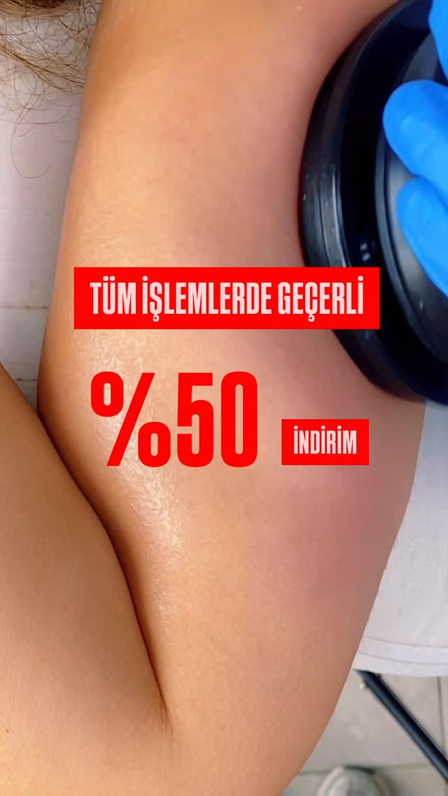 SINIRLI KONTENJAN İÇİN GEÇERLİ💫
Yararlanabileceğiniz işlemler;
Lazer epilasyon
G5 masajı
Neocare lifting terapi
Neocare selülit bakımı
Neocare bölgesel incelme
Mslim xlpro sıkılaşma
Mslim xlpro pelvik terapi
Mpgun vitamin bakımı
Mpgun saç dökülmesine karşı bakım
Aqua ex3 detaylı cilt bakımı
Mesolab biyofotonik terapi ile cilt yenileme
Mesoestetic leke peeling çeşitleri
Clear&Brilliant lazerle cilt yenileme
İğneli epilasyon
Kaş vitamini
Dilerseniz satın alıp hemen başlayabilir dilerseniz şimdi satın alıp 1 yıl içerisinde kullanıma başlayabilirsiniz.
Mevcut kullanım paketleriniz varsa kampanya dahilinde satın aldığınız uygulamaları devamında süre sınırı olmadan kullanabilirsiniz.
Ücretsiz ön görüşme ve bilgi için iletişim
📲05467807976
#bodrum #bodrumgüzellik #bodrumgüzelliksalonu