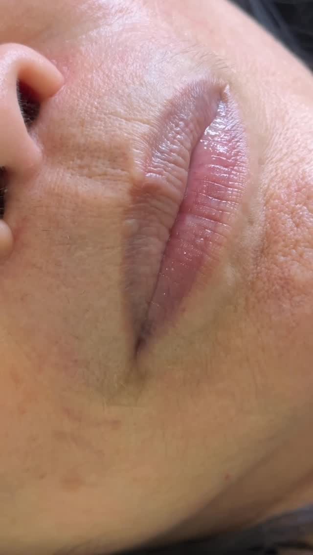 Liptattoo #phunmoi #permanentmakeup #liptattoo