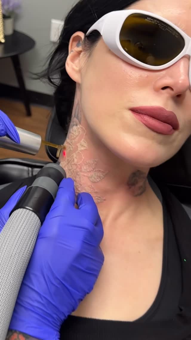 Thank you @removery for making my 18 year sober anniversary even more memorable! I love that I’ll soon be able to wake up to a clean slate! 🥹
Love you @dustinortel + @al_smileyface for the always taking care of my tattoo mess! 🖤