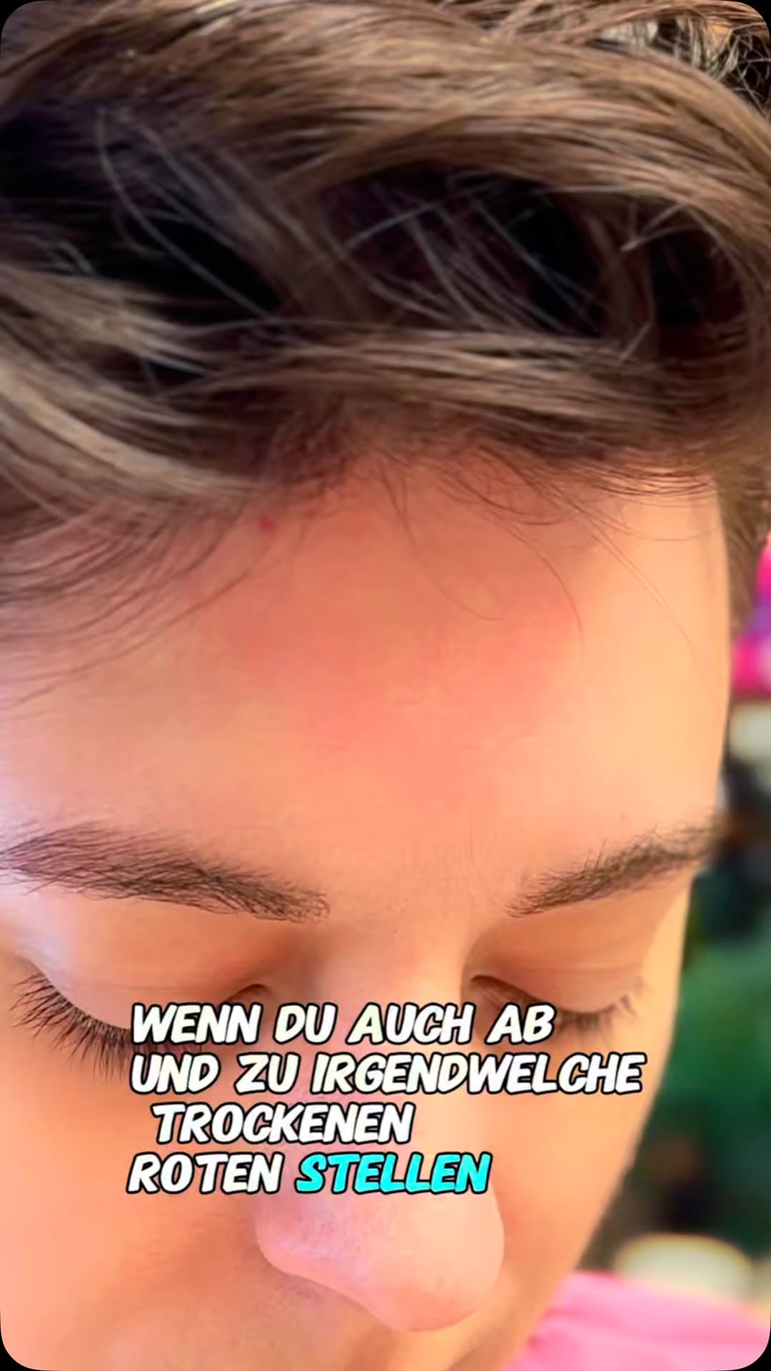 🧴 Rötungen, Juckreiz oder trockene Stellen?
Ich zeig dir heute was, das meiner Haut wirklich hilft – ganz ohne großes Tam-Tam. 🌿✨
Manchmal reicht ein Tropfen Natur, um spürbar Erleichterung zu bringen.
Diese Stelle auf meiner Stirn war vorher total gerötet – jetzt? Fast weg.
💧 Rosacea & Couperose Öl mit Kukuinuss, Wildrose, Traubenkern & Mohnsamenöl
➡️ beruhigt
➡️ lindert Juckreiz
➡️ stärkt die Hautbarriere
Ich vermute: der plötzliche Wetterumschwung war zu viel für meine Haut. Vielleicht kennst du das auch?
Dann bleib dran – deine Haut braucht vor allem Verständnis und die richtigen Impulse. 🌬️🌤️
✨ Schreib mir in die Kommentare, wenn du solche Stellen kennst – oder ganz privat per Nachricht. Ich bin für dich da. 💜
Spüre den Unterschied. Weil du wertvoll bist.
.
.
.
#rosacea #couperose #naturkosmetik #hautberuhigung #roteflecken
#hautpflege #kukuinussöl #simplydrop #spüredenunterschied #hautbalance
#pflegeausliebe #gesichtspflege #trockenestellen #empfindlichehaut #biohautpflege
#veganeskosmetik #greenbeauty #skincaretips #beforeandafter #skincarejourney