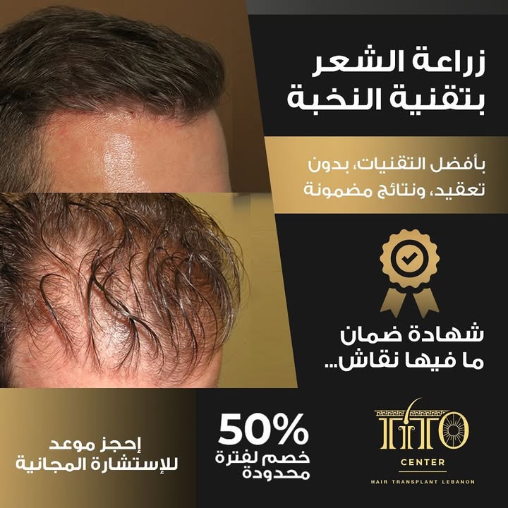 زراعة الشعر ما عادت عملية معقّدة!
بتقنية متطورة، ومن دون حلاقة أو ألم، بنرجّع الكثافة والنتيجة مضمونة بشهادة رسمية.
احجز استشارتك المجانية اليوم وشوف الفرق بنفسك.
Hair transplant doesn’t have to be complicated.
With advanced technology, no shaving, and no pain, we restore hair density with guaranteed, certified results.
Book your free consultation today and see the transformation yourself.
#HairTransplant #MensHairRestoration #DHItechnique #GuaranteedResults #ThickerHair #HairClinic #BeforeAndAfter