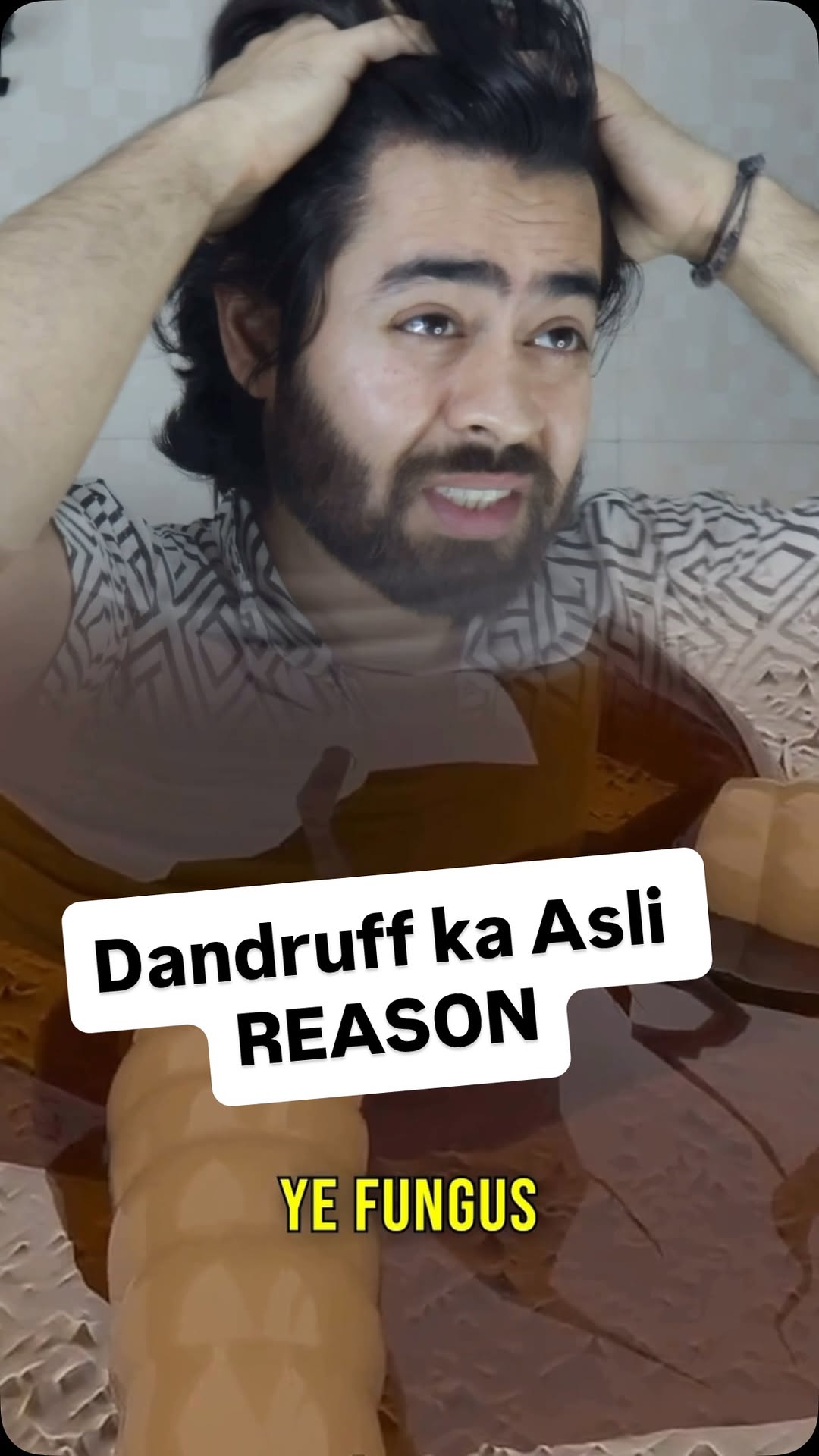 Comment “HAIR” for link or share this reel in my DM for link
I Tried Pilgrim Anti-Dandruff Shampoo for 2 Weeks – Here's What Happened! 😱 | Honest Review
Dandruff was literally ruining my scalp for the last 2 months – constant itching, flakes everywhere, and no shampoo seemed to work. I tried multiple so-called anti-dandruff solutions but got ZERO relief… until I discovered Pilgrim Anti-Dandruff Shampoo.
After just 2 washes, I got 90% relief from itching and flakes. This shampoo is a game changer if you're struggling with dandruff, dry scalp, or itchiness. In this video, I’m sharing my honest experience with Pilgrim – no paid promo, just real results.
👉 Watch till the end to know if it’s worth your money or not!
#dandruff #antidandruffshampoo #dandruffshampoo #dandruffsolution #itchyscalp #pilgrimshampoo #scalpcare