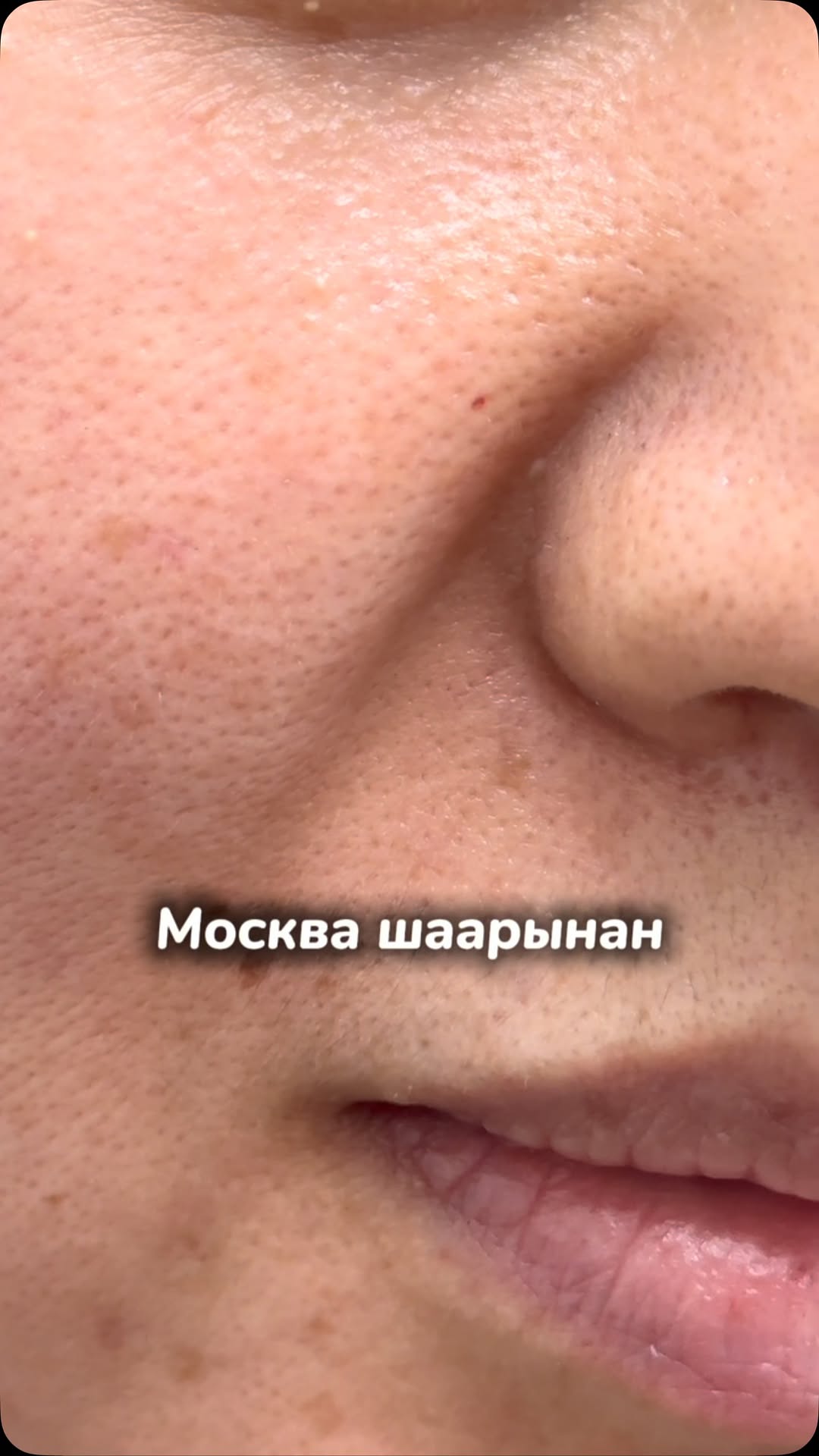 Сиздин дагы порыларыңыз кеңейип кеттиби?
Мен ар дайым айтып келем, өз алдынча үй шартында уход кылбаңыз деп. Эгер сиздин дагы порыларың кеңип кетсе биздин клиникага келиңиз.
Порыны ичкертүүчү атайын уход кылып, косметика тандап беребиз.
18-19-20 Июль Москва шаары.🇷🇺
ИНЪЕКЦИЯСЫЗ, АГАРЫП, ЖАШАРУУНУ КААЛАСАҢЫЗ ДЕМЕК БУЛ ПРОЦЕДУРА СИЗ ҮЧҮН. 🔽
18-20 Июль Москва шаары 🇷🇺
📍 г.Москва ул.Ивантеевская 21, Бульвар Рокоссовского. Мед центр Барсмед
