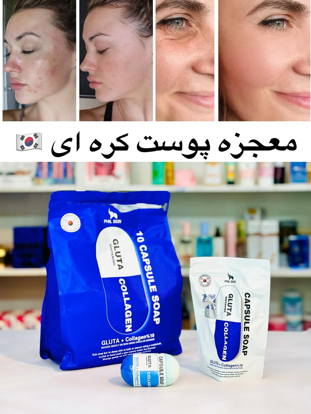  صابون ۲ کاره کره ای رسید برامون خود معجزه پوست 🇰🇷👌👌
دو تا ترکیب کنار هم
یه قسمتش درمان کننده دائمی سیاهی و لک و تیرگی صورت و بدن
و یه قسمتش هم عصاره چای سبز و درمان جوش ملتهب و خشک کننده جوش و از همه مهم تر چربی پوستتو کنترل میکنه که دیگه جوش جدید هم نزنی 👌👌🥳
در کل بهت بگم این محصول هیچ جا با این قیمت پیدا نمیکنی
محصول اصل کره جنوبی
فوق العاده موثر و تا عید یه پوست بی عیب و نقص بهت تحویل میده
فقط مرتب و یک روز در میون استفاده کنید
قیمت اصلی ۲۸۵ ت
با تخفیف تا فردا شب فقط ۲۱۵ ت ❌👌