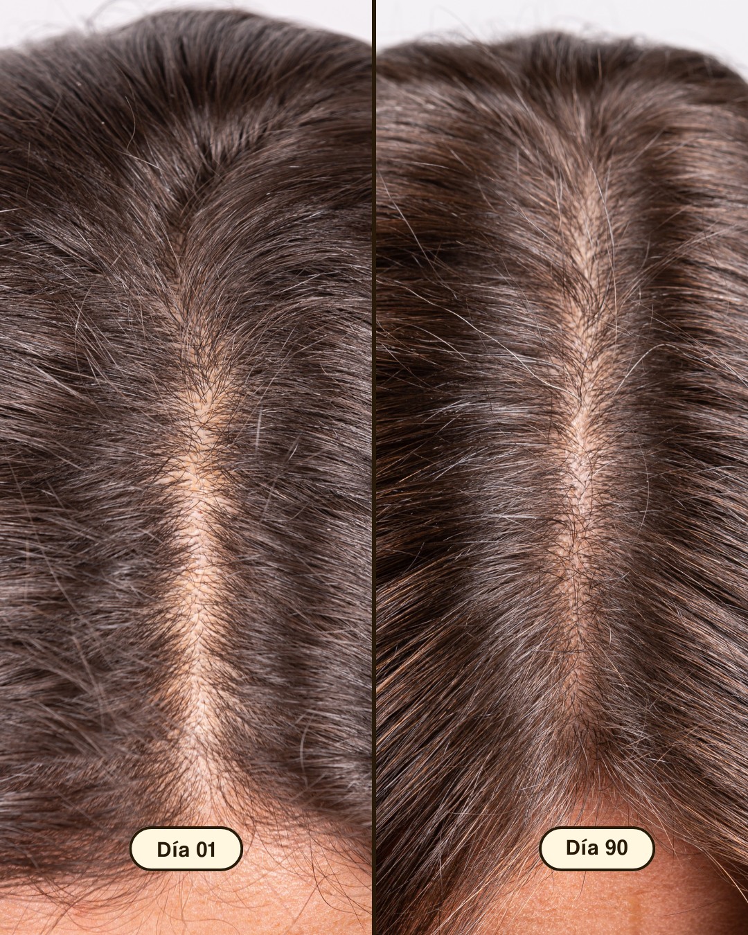 Si tu pelo se cae más de lo que te gustaría, esto te interesa 👇
Hair Growth & Density Treatment 🌱
👉🏼 Recupera la fuerza, estimula el crecimiento y reduce la caída del cabello.
👉🏼 Aplicación rápida, resultados visibles y estudios que lo confirman.
Cada día recibimos vuestras fotos del antes y el después y no podemos estar más felices.🤎
💥 ¿Sabías que con los FRESHLY DAYS puedes conseguirlo AHORA hasta con un -40% de descuento? Corre al LINK de la BIO 🚀