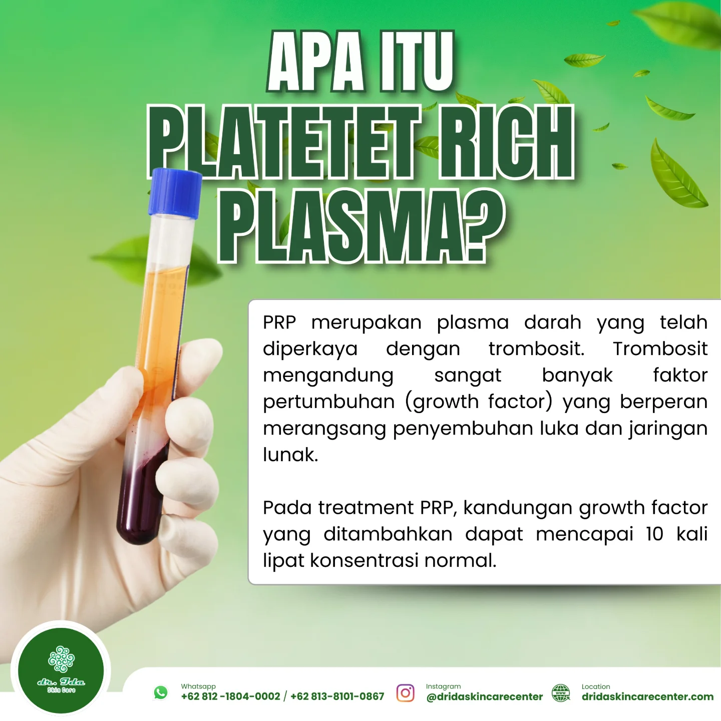 {APA ITU PRP}
Platelet-Rich Plasma (PRP) adalah terapi yang menggunakan plasma darah yang kaya akan trombosit untuk merangsang proses penyembuhan alami tubuh dengan cara meningkatkan faktor pertumbuhan tertentu.
PRP diambil dari darah pasien sendiri, diproses untuk mendapatkan plasma yang kaya akan trombosit dan growth factor yang diaplikasikan ke wajah dengan menggunakan alat dermapen dan jarum roller.
Syarat pasien yang akan melakukan PRP :
1.Kesehatan umum yang baik
2.Tidak sedang hamil atau menyusui
3.Tidak sedang menggunakan obat pengencer darah
4.Kondisi kulit tertentu: pasien yang memiliki bopeng, flek bekas jerawat, atau masalah kulit lainnya yang memerlukan perbaikan tekstur dan regenerasi sel dapat menjadi kandidat yang baik.
Semoga bermanfaat untuk mengenal lebih banyak seputar treatment PRP dan akan menjadi pilihan treatment terbaik untuk atasi masalah kulitmu...✨️🥳🎉⚘️🤗
#dridaskincare#klinikkecantikanbogor#produkamanbpom#perawatanwajah#prp#pilihantreatmentbopeng#treatmentporibesar#treatmentflekbekasjerawat#bebasflek#bebaspporibesar#bebasscaracne#kulitsehat#kulitbersinar#kulitglowing#menyala