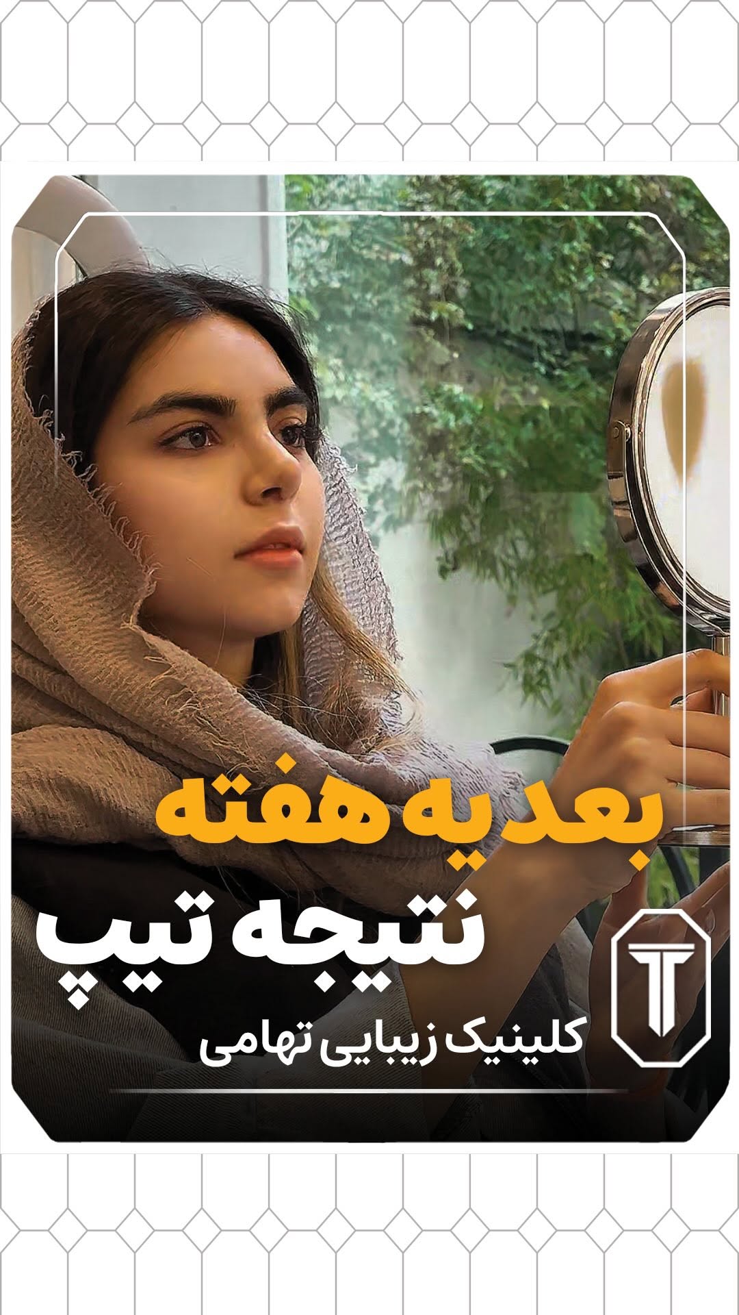  دوست داری فرم نوک بینیت بهتر بشه 🤔👃🏼
اما از بیهوشی و جراحی کامل میترسی؟
خبر خوب اینه که با تیپپلاستی
بدون بیهوشی
بدون برش وسیع
و با کمترین دوران نقاهت
میتونی نوک بینیتو خوشفرمتر و طبیعیتر کنی!
تو کلینیک تهامی، این روش بهصورت کاملاً تخصصی و ایمن انجام میشه، مخصوص افرادی که بینی گوشتی استخوانی و.. دارند
حالا بهنظرت تیپپلاستی برای تو مناسبه؟
کامنت بذار یا بهمون دایرکت بده تا مشاوره رایگان برات رزرو کنیم!
شاید فقط یه قدم با بینی دلخواهت فاصله داشته باشی!
📍 آدرس: تهران، جردن
📞 مشاوره و نوبتدهی: 09120169617 | 71031-021
#تیپ_پلاستی #بدون_بیهوشی#جراحی_بینی #رینوپلاستی #جراحی_بینی_بدون_درد #نوک_بینی_زیبا #کلینیک_تهامی #زیبایی_صور