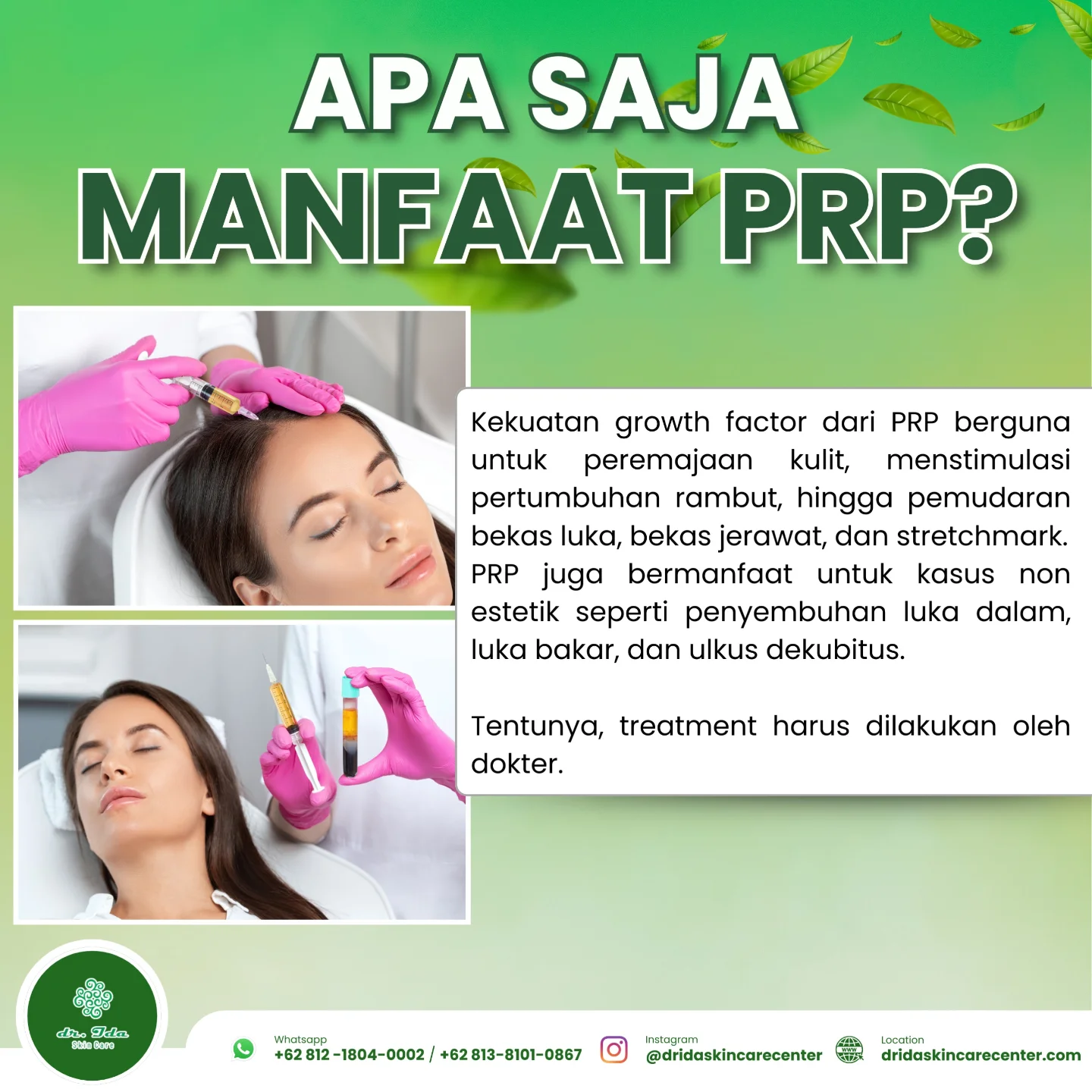 {MANFAAT PRP}
Manfaat Treatment PRP :
*Peremajaan kulit
*Atasi Bopeng bekas jerawat
*Flek / luka bekas jerawat
*Anti aging mengatasi penuaan dini
*Strechmark di tubuh
*Merangsang pertumbuhan rambut rontok / atasi kebotakan
Kalo sudah tahu manfaatnya, kenapa harus di tunda - tunda ambil treatmentnya...yuuk segera konsultasikan ke dokter agar masalah kulitmu mendapatkan solusi terbaiknya...✨️🥳🎉⚘️🤗
#dridaskincare#klinikkecantikanbogor#produkamanbpom#perawatanwajah#prp#pilihantreatmentbopeng#treatmentporibesar#treatmentflekbekasjerawat#bebasflek#bebaspporibesar#bebasscaracne#kulitsehat#kulitbersinar#kulitglowing#menyala