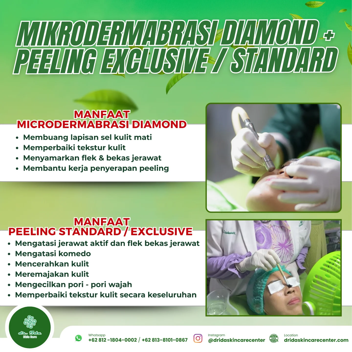{MICRODERMABRASI +PEELING}
Mau hasil treatment peeling maksimal ?
Perawatan kulit unggulan untuk hasil terbaik, ambil yuuk treatment mikrodermabrasi dan peeling exclusive / standard....
Mikrodermabrasi diamond akan bekerja mengabrasi dan mengikis sel kulit mati serta membuka pori - pori wajah, sehingga kerja cairan peeling bisa lebih dalam dan bisa bekerja lebih optimal.
Eksfoliasi maksimal, kulit glowing maksimal, tekstur kulit lebih halus dan lembut,
bebas flek...pilihan tepat atasi masalah bopeng dan flek bekas jerawat dengan mikrodermabrasi dan peeling....✨️🥳🎉⚘️🤗
#dridaskincare#klinikkecantikanbogor#produkamanbpom#perawatanwajah#pilihantreatmentbopeng#treatmentporibesar#treatmentflekbekasjerawat#bebasflek#bebaspporibesar#bebasscaracne#kulitsehat#kulitbersinar#kulitglowing#menyala