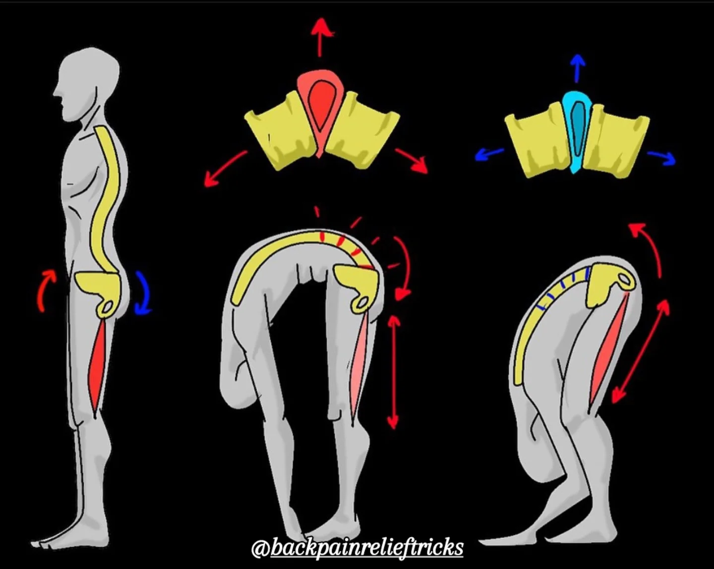 Your spine is not just a column of bones — it’s the central pillar of your existence.
It protects your nervous system, supports every movement you make, and connects mind and body in ways we’re only beginning to understand.
Yet most of us don’t pay attention to it…
Until it’s too late.
Until the pain starts.
Until sitting, standing, or sleeping becomes a challenge.
So let this be your reminder:
Spinal health is not optional. It’s foundational.
When you slouch, your spine suffers.
When you sit for hours without moving, your discs compress.
When your core is weak, your spine takes the load.
And when your posture breaks down — so does your energy, your breath, and even your confidence.
But here’s the good news:
You can reverse this.
Start with awareness.
Sit tall. Lengthen your spine as if someone were pulling a string from the crown of your head.
Move often. Even a 30-second stretch every hour can undo hours of pressure.
Strengthen your core — not just your abs, but the deep stabilizers that hold your spine like cables on a suspension bridge.
Learn to hinge at your hips, not your back. Protect your lumbar spine with intelligent movement.
And above all… listen to your body. Pain is a whisper before it becomes a scream.
Spinal health isn’t about perfection.
It’s about daily habits that add up to a pain-free, powerful life.
Take care of your spine — it’s the only one you’ve got.
And when it’s strong, so are you.
Follow @backpainrelieftricks 👈