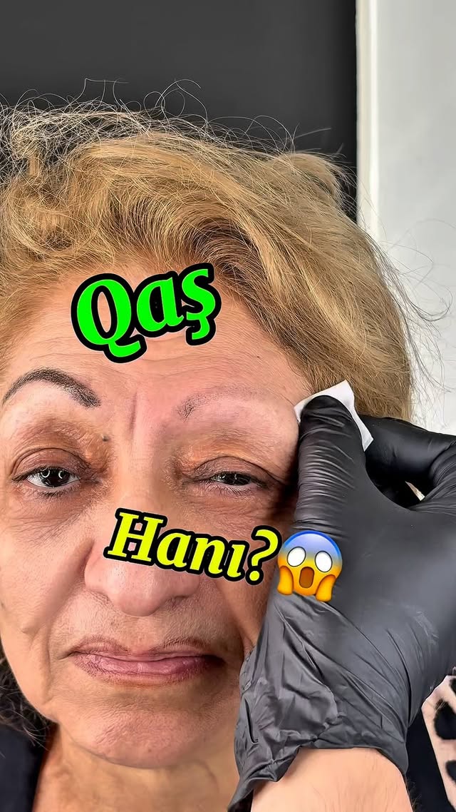 İlk seansdan sonra qaşlarda bir qədər solma tamamilə normaldır. Bu, sağalma prosesinin bir hissəsidir və korreksiya ilə istədiyimiz nəticə alınacaq.
✨Tanımadan hökm vermək, öyrənmədən danlamaq bu önyarğının başqa adıdır. Bir az anlayış, bir az da hörmət yetər.
#nanobrows #microblading #brows #keşfet #
