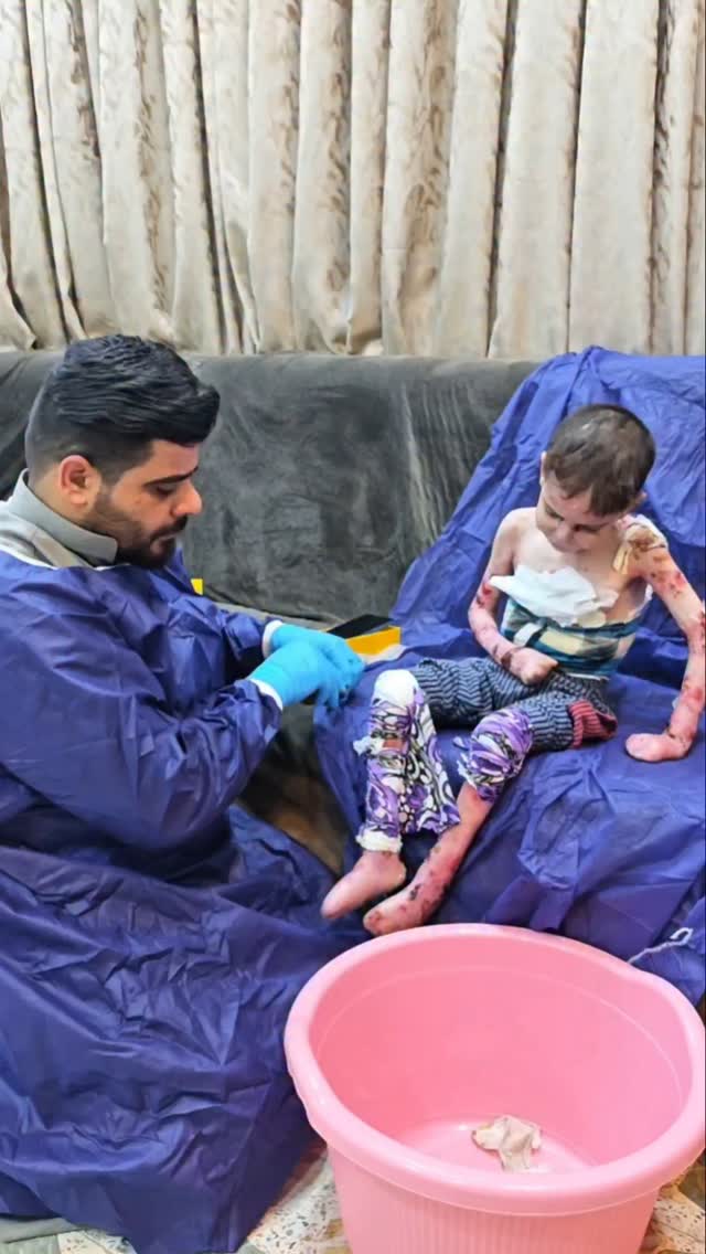 دار حديث بيني وبين عائلة الطفل محمد
خلي اسولف بالچلفي حتى تفهمني اكثر
كتلهم يابة ليش مماخذين الطفل للمستشفى كالولي واللّٰه ياستاذ ماعدنة كروة نروح بيها للمستشفى
هنا اني سكتت وبديت افتح بالضمادات وابواع عليهن وصل تعبانة ومنتهية مشككات
كتلها خالة ام محمد هاي شنو الوصل منين جايبتهن؟
كالتي واللّٰه ياخالة هاي البردة مال الشباك فصلتها واخلي اوراق وكنيلس واضمد الجروح
هنا اني ضحكت كتلها خالة چا والشباك شلون؟ شحطيتيلة ستر؟ كالت خالة ربك هو الساتر وسكتت
كتلها ونعم باللّٰه بس سولفيلي على الشباك بيش سيدتي كالت خالة مابي جامة سفطنالة طابوكات وسدينا.
اعتذر بعد ماكدر اكمل لأن كل شي بداخلي يبچي اللّٰه يشهد اكتفي بهذا القدر من التوضيح.
#العراق