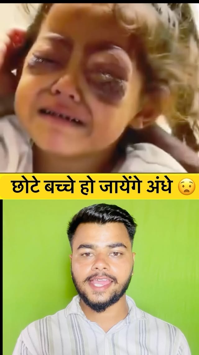 छोटे बच्चे हो जायेंगे अंधे 😧
:
:
: