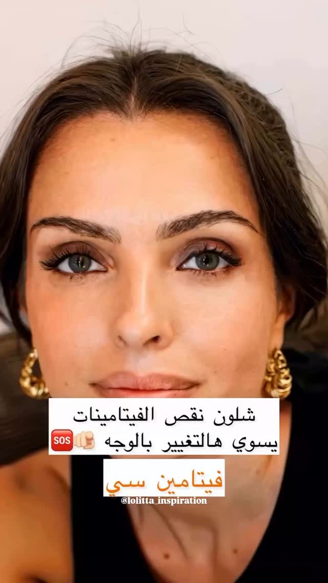 تأثيرات نقص الفيتامينات على الوجه و البشرة انتبهوا 😩🎀
Follow me for more @lolitta_inspiration ✅️ ❤️