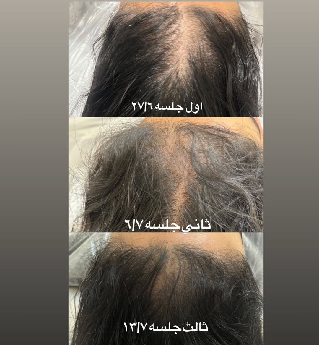 كورس الشعر مع لطيفة الزبن