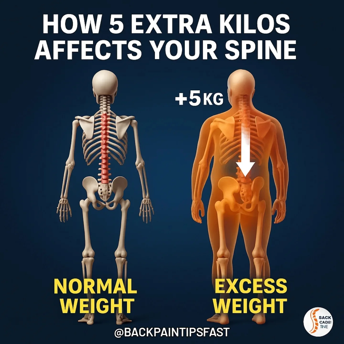 Your Spine Wasn’t Built to Carry the Weight of the World… Yet That’s Exactly What 5 Extra Kilos Can Do.
🔬 A recent study revealed something shocking:
Just 5 extra kilos (11 lbs) can increase your risk of chronic back pain by up to 30%.
Here’s why:
When you carry excess weight—especially around the belly—it shifts your center of gravity forward.
Your spine responds by arching unnaturally, compressing discs, and placing immense stress on your lower back.
It’s not just about looks.
It’s about pressure.
Tension.
Misalignment.
Pain.
The good news? Even small changes can make a massive difference.
Drop the weight → reduce the pressure → restore your posture → feel the relief.
⚖️ Your spine supports your body every single day.
The question is… are you supporting your spine?
Dm me "back" and I'll send you the best way to decompress your spine and consequently relieve your back pain