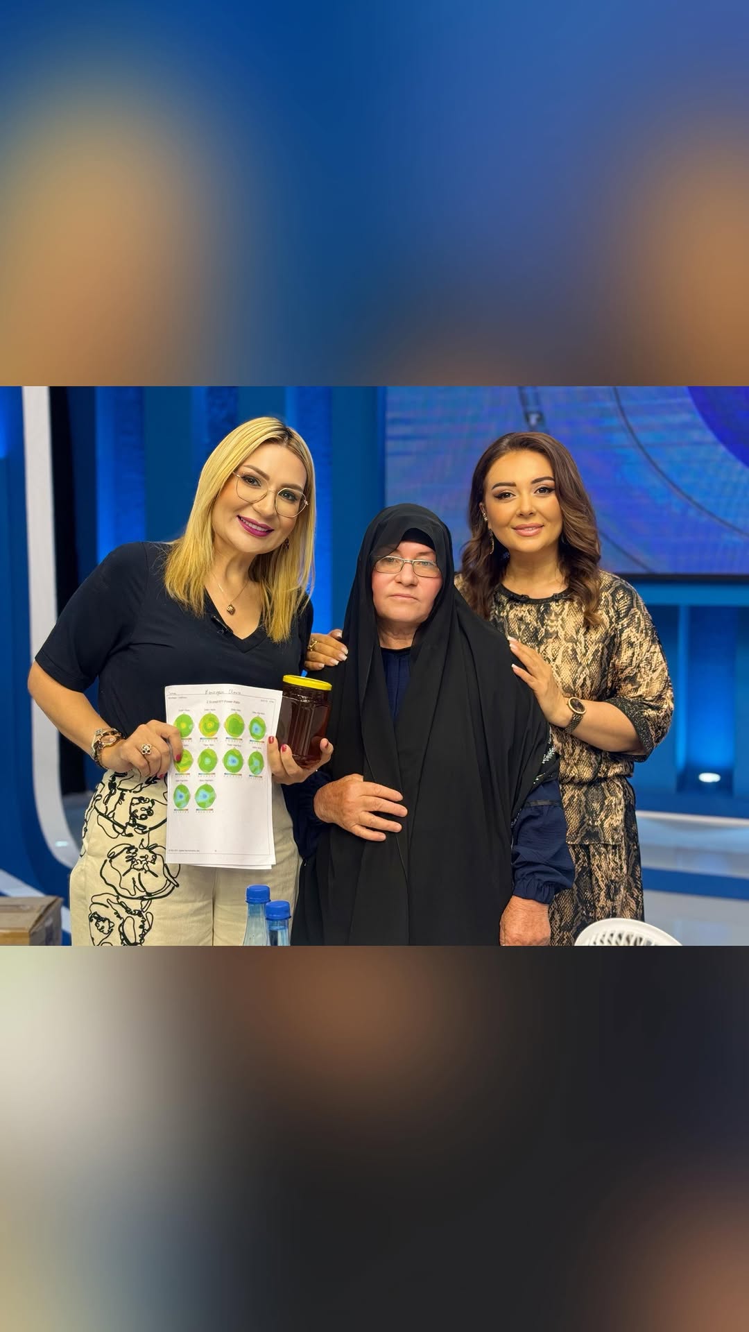 Ağsudan olan 71 yaşlı Elmira anamızı Narınc Psixologiya Mərkəzinə əmanət etdik. O, gecələr yata bilmirdi, yuxusuzluqdan və yaddaşsızlıqdan əziyyət çəkirdi.🥹 Başında küy və uğultu var idi, sanki beyninin içində səslər gəldiyini deyirdi. Gecələr 2-3 dərman içməsə yata bilmirdi.🤯
Elmira anamız 7 balanı tək böyüdüb, gənc yaşında həyat yoldaşını itirib. Daha sonra cavan oğlunu və nişanlı qızını da itirərək böyük travmalar yaşamışdı.😢 Bu ağır itkilər onda qorxu, təşviş və həyəcan yaratmışdı. Danışanda bədəni tir-tir əsirdi və nəfəsi belə dəyişirdi. Həyatı ona artıq mənasız gəlirdi, gündəlik işlərini belə görməkdə çətinlik çəkirdi. Yaddaşsızlıq səbəbindən sadə şeyləri belə tez-tez unudurdu.
İlk dəfə mərkəzimizə gələndə gözlərində ümid qalmamışdı. O, yalnız bir az rahatlamaq istədiyini deyirdi. Narınc Psixologiya Mərkəzində ona xüsusi proqram tərtib olundu. Psixoloq dəstəyi və möcüzəvi aparatlarla seanslara daxil edildi.🥰 Cəmi 20 seansdan sonra nəticələr hiss olunmağa başladı. Elmira anamız yavaş-yavaş yuxusuna qovuşdu və gecələri dərmansız yatmağa başladı.😍
Başındakı küy və uğultu tamamilə yox oldu. Əvvəlki həyəcan və təşviş də aradan qalxdı. İndi isə o, özünü daha sakit, gümrah və xoşbəxt hiss edir. Danışanda əvvəlki kimi əsə-əsəmir, nəfəsi rahatdır. Bu möcüzəvi nəticə Narınc Psixologiya Mərkəzinin peşəkar komandası sayəsində mümkün oldu. Elmira anamız indi yeni həyata, sakitliyə və ümidə qovuşub.🤗🧡
@tesirdairesi @azertash
#narıncpsixologiyamerkezi #təsirdairəsi #xəzərtv #aparat #psixolojidəstək #narıncmöcüzələri