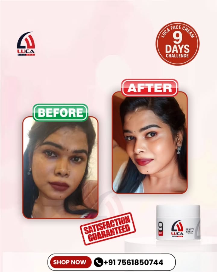 Happy Customer Alert! ✨
Just 09 days and the glow is real with Luca Beauty Cream 💖
✅ Reduced pimples
✅ Faded dark spots
✅ Brighter, smoother skin
📦 Order now & see the magic yourself!
📞 +91 7306280744 | +91 7561850744
🌐 lucasworld.shop
#LucaBeautyCream #GlowingSkin #SkincareResults #HappyCustomer #LucaResults #SkinTransformation