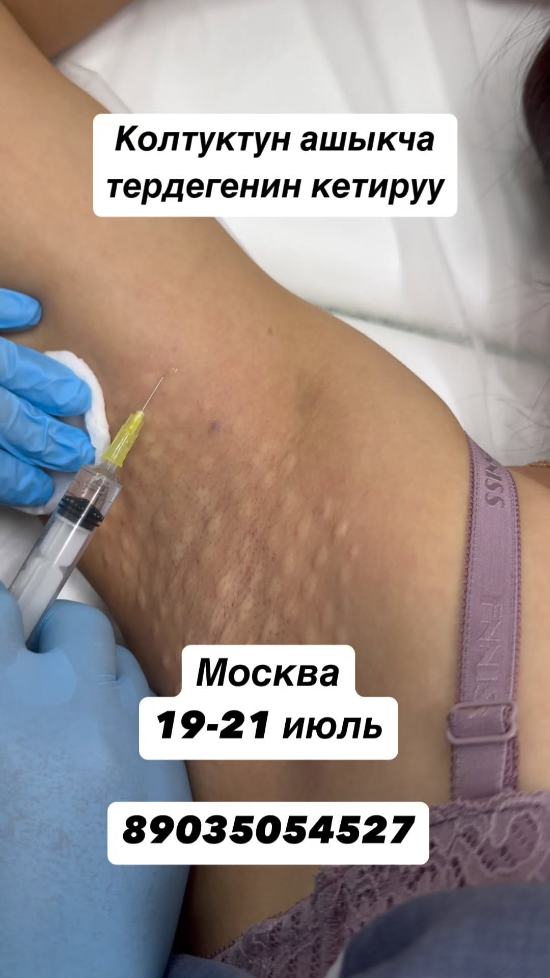 89035054527
Москва шаары 19-21 июль сизди кутобуз ❤️
Метро 🚇 Бульвара Рокоссовского 1 мин от 2 выхода