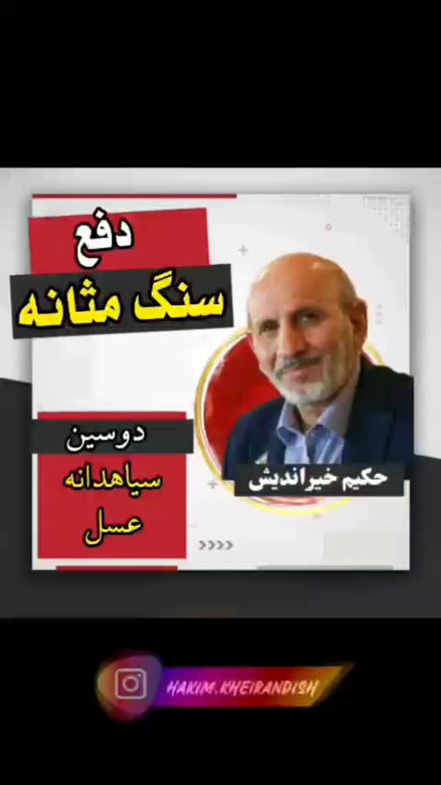🔴 درمان سنگ کلیه
♻️ در قسمتهای قبل با این بیماری و علائم آن آشنا شدیم. اگر #سنگ_کلیه درمان نشود منجر به عفونت ادراری و از کار افتادن کلیهها میشود.
🔹 جهت درمان سنگ کلیه علاوه بر دارو، پرهیزهای غذایی نیز لازم است: پرهیز از غذاهای غلیظ و دیرهضم که چربیهای غیر طبیعی دارند، پرهیز از سوسیس و کالباس، گوشت گاو، شتر، ماهی نپخته، چای زیاد، شیر پرچرب، بادام زمینی، شکلات، سویا نیز لازم است.
🔹 یکی از بهترین داروها در دفع سنگ کلیه گیاه #بنسرخ یا بونسر میباشد که گیاهی کوهی است و جوشانده آن سنگ کلیه را حل میکند و آن را از دستگاه ادراری خارج میکند.
✅ در سنگ کلیه باید از داروهایی استفاده کرد که اولاً #مفتت باشند یعنی خرد کننده سنگ و ثانیاً #مدر باشند یعنی ادرارآور باشند که سنگ به سهولت خارج شود:
🔸 داروهای مفتت مثل گزنه، تخم خربزه، خارخسک، سداب، پرسیاوشان، سرکه سیب
🔸 و داروهای مدر مثل تاجریزی، تخم خیار، کاکل ذرت، دم گیلاس و خارشتر، هندوانه پخته شده
❗️ در سنگهای بالای چهار و پنج میل باید هفته اول فقط سنگ شکن بدهید و سپس مدر دهید.
اگر سنگ بسیار مقاوم بود و با ترکیبات بالا دفع نشد، داروی #حجرالیهود که یکی از بهترین سنگ شکنهاست و تدبیر دارد، با مشورت و تجویز طبیب حاذق استفاده شود.
✅ به صورت موضعی برای تسهیل دفع سنگ کلیه، نشستن در تشت #آب_گرم یا #جکوزی مفید است زیرا حالب را باز میکند همچنین استفاده از روغنهایی که رخوت ایجاد میکند مثل روغن #شوید یا #سیاهدانه و #بادکش_لغزان در مسیر کلیه به مثانه، پایین آمدن از #پله و #طناب_زدن به دفع سنگ کمک میکند.