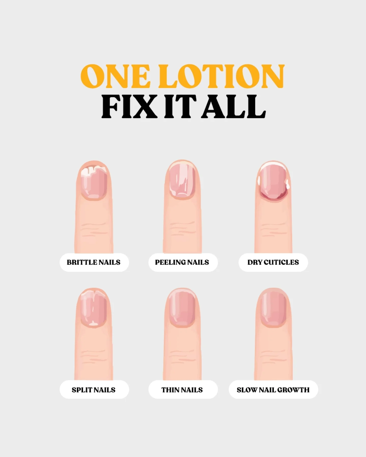 Different nail problems?
One simple solution.✨🤩
From breakage to peeling, our Nail Lotion is ready to make you nail it!💚
Shake well,don’t press and apply gently on the cuticles
مشاكل الضوافر كتیر بس علاجھا منتج واحد!✨😍
أطلبي دلوقتي الlotion Nail من رو أفریكان، واستني نتایج ھتبھرك.💚
#NailItWithRaw #NoMoreBreaks #RawAfrican #BeRaw