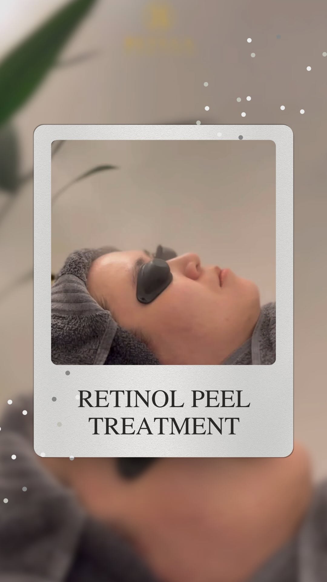 Kulit Kusam? Jerawat Degil? Parut Tak Nak Hilang โ๏ธ๐จ
Itโs time to glow up dengan RETINOL PEEL ๐ฅ
Retinol Peel ni power sebab ๐๐ป
โญ๏ธ Bantu kurangkan jerawat & parut
โญ๏ธ Cerahkan kulit kusam
โญ๏ธ Haluskan tekstur kulit
โญ๏ธ Galakkan kulit baru yang lebih sihat & glowing
Kulit sihat = keyakinan meningkat!โจ
๐Beylla Medispa โ tempat transformasi kulit bermula
#RetinolPeel #BeyllaMedispa #KulitGlowing #NoMoreJerawat #KulitKusamBye #ParutPudar