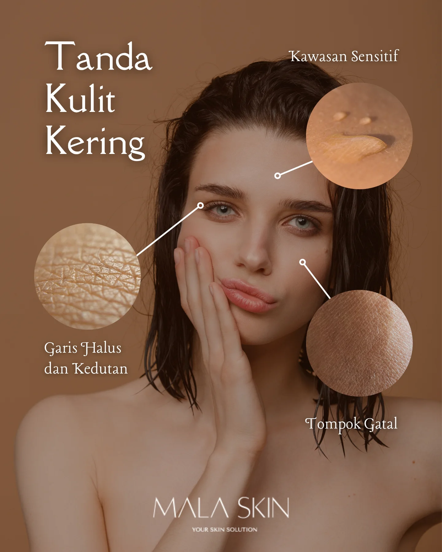 💧 Jangan biarkan kulit terus menderita. Dapatkan rutin penjagaan khas dari MALA SKIN – Your Skin Solution yang diformulasi untuk melembap secara mendalam, menenangkan iritasi dan memulihkan keseimbangan semula jadi kulit anda.
#MalaSkin #SkinExpert #DrSkin #YourSkinSolution
