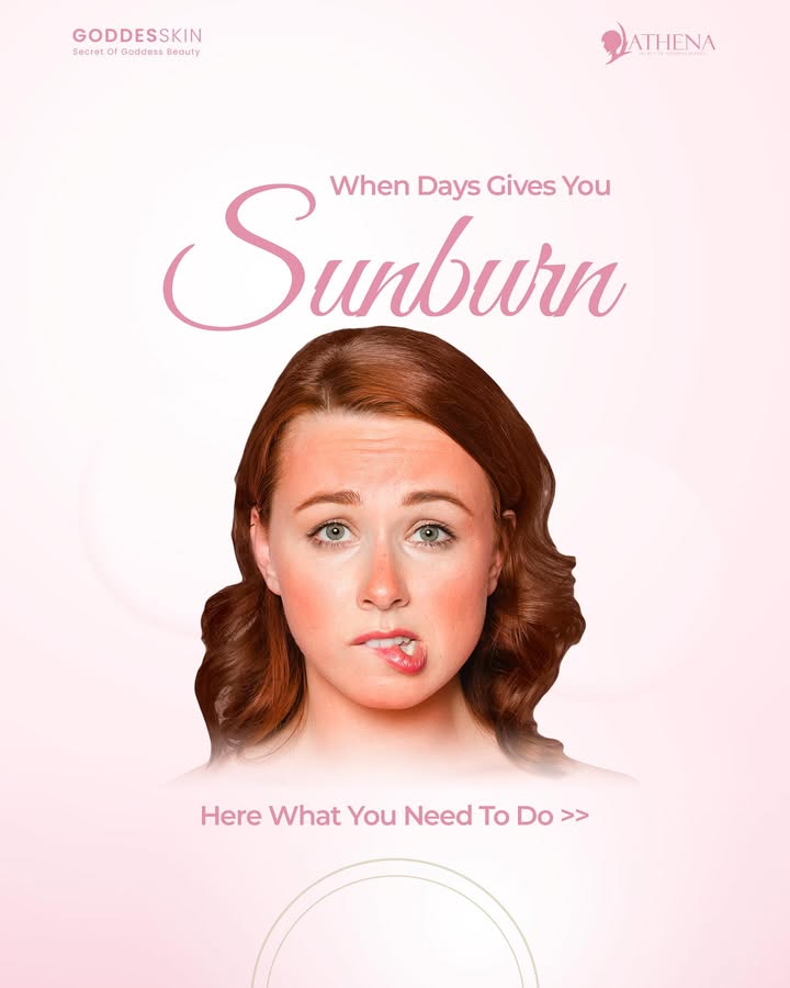 When days give you sunburn☀️🔥
Time to turn the burn into glow!✨
Here’s what your skin actually needs
