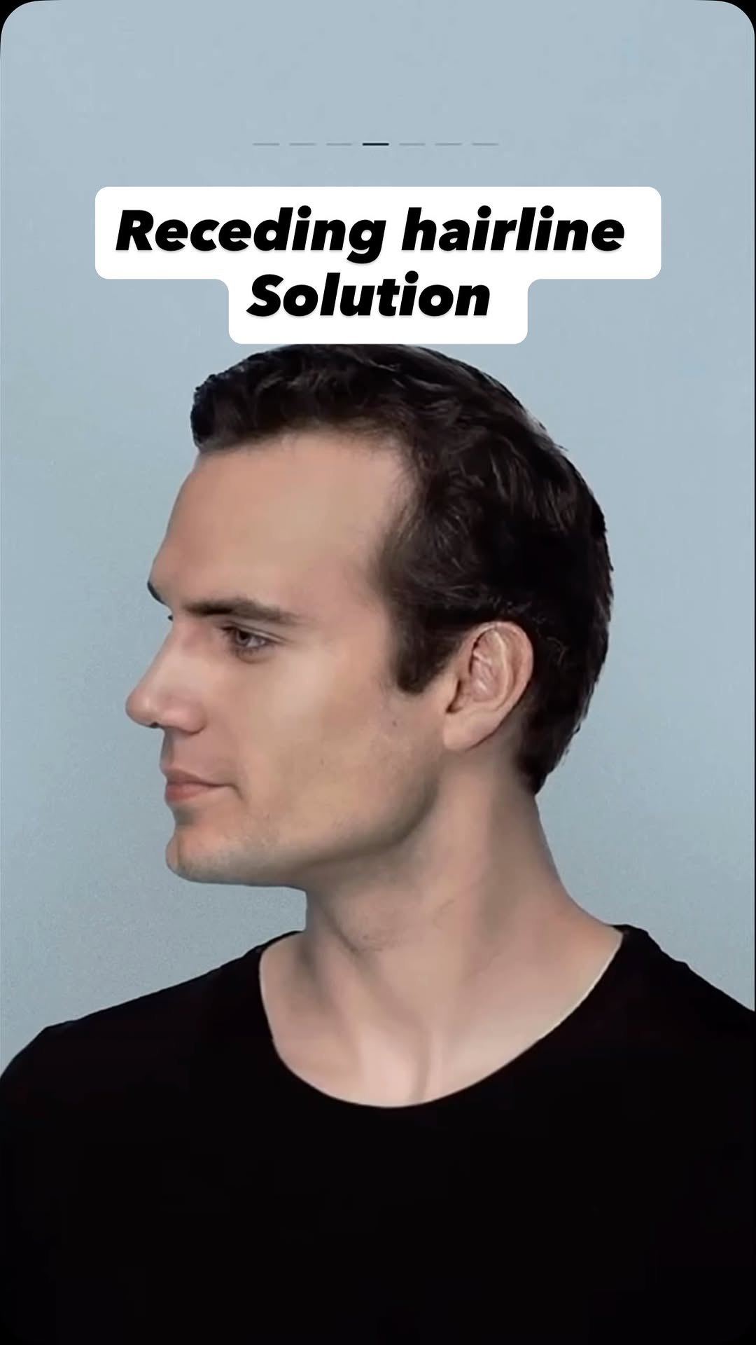 Comment “GROW” for link or share this reel in my DM for link
Bhai agar hairline peeche ja rahi hai to ye tumhare liye last wake-up call hai ⚠️
Doctors keh chuke hain – dead hair follicle wapis zinda nahi hota, chahe kuch bhi karlo!
Hair transplant bhi sirf existing follicles ko shift karta hai.
To agar kuch karna hai to **abhi karna padega – jab tak baal zinda hai!**
💧 Try this water-like **Bare Anatomy Advanced Hair Growth Serum** with 3% Redensyl, Biotin, Rosemary & 7 powerful actives.
Clinically proven to grow up to **10,000 new hair strands in just 3 months.**
I've personally used it for a year – ye kaam karta hai!
👇 Comment **"GROW"** and I'll send you the link.
✅ Hairfall Control
✅ Baby Hair Growth
✅ Stronger, Thicker Hair
✅ Scientifically Proven Ingredients
✅ No Itching, No Flaking
Hairfall solution for men, rosemary oil for hair growth, redensyl serum review, how to regrow hair naturally, best hair growth serum, no minoxidil hair growth, DHT blocker rosemary, advanced hair serum India, bare anatomy hair serum, hair thinning solution, baby hair regrowth, baldness solution for men, haircare for men India, hair growth without side effects, head2toe hair tips, 3% redensyl benefits, male pattern baldness remedy, hair fall recovery journey, hair serum that works, Indian grooming tips
#HairfallSolution #RecedingHairline #HairSerum #BareAnatomySerum #HairLossTreatment #MensHairCare #HairGrowthJourney #BaldingSolutions #HairRegrowth #Redensyl #BiotinSerum #StopHairfall #MensGrooming #GanjaMatBano #HairCareRoutine #HairGrowthTips #ThinningHairFix