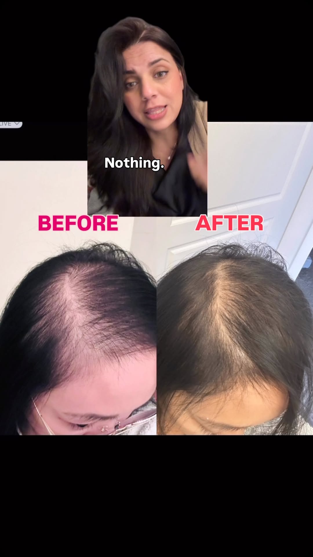This is why I do what I do!
This is why Amazing Hair Saviour is absolutely ground breaking!
This is why I consistently keep showing you guys thousands of happy clients!
This is why Amazing Hair Saviour has the support that it does!
This is why you guys love it.
4 simple ingredients with no chemicals and no fuss, just results ❤️
This is why I refused to compromise on quality and stay consistent with my process of extraction (which is patented) and my little studio!
This is why you love Amazing Hair Saviour and I love you guys back times 10 because you keep showing up for me and sharing the results ❤️
Let’s get growing
Love you
Amber 😘
#amazinghairsaviour #hairlosssolution #hairtransformation #alopeciaareata #hairgrowthoil #alopecia #hairgrowth #hairtransformation #beforeandafter
