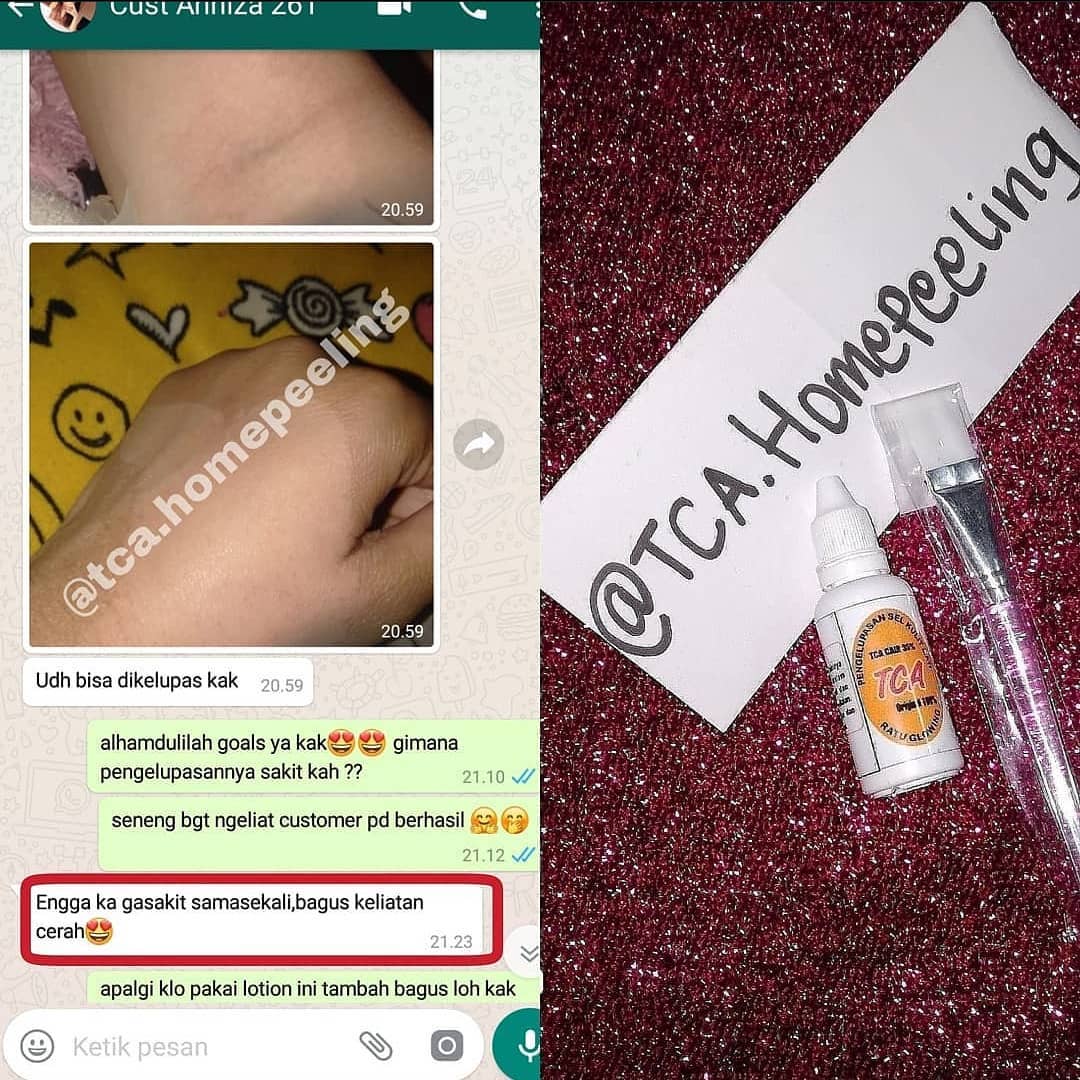 👇👇
DM dan WA +6285200 696867 ( FAST RESPON )
NO CALL 📵
#tca #tcapeeling #peeling #peelingmurah #peelingaman #tca35% #tcaaman #pemutih #pengelupasanbadanaman #bengkulu #palembang #kupang #bengkulu #ntt #aceh #tcaaman #bekasi #bekasi #bekasihits #cilegon #peelinggelmurah #peelingbadan #peelingwajahdokter #carapakaipeeling #sulawesiselatan #sulawesitenggara #sulawesi