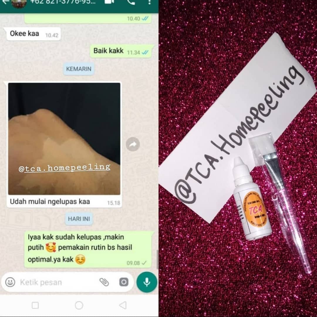 MasyaAllah asal rutin bisa jadi cerah